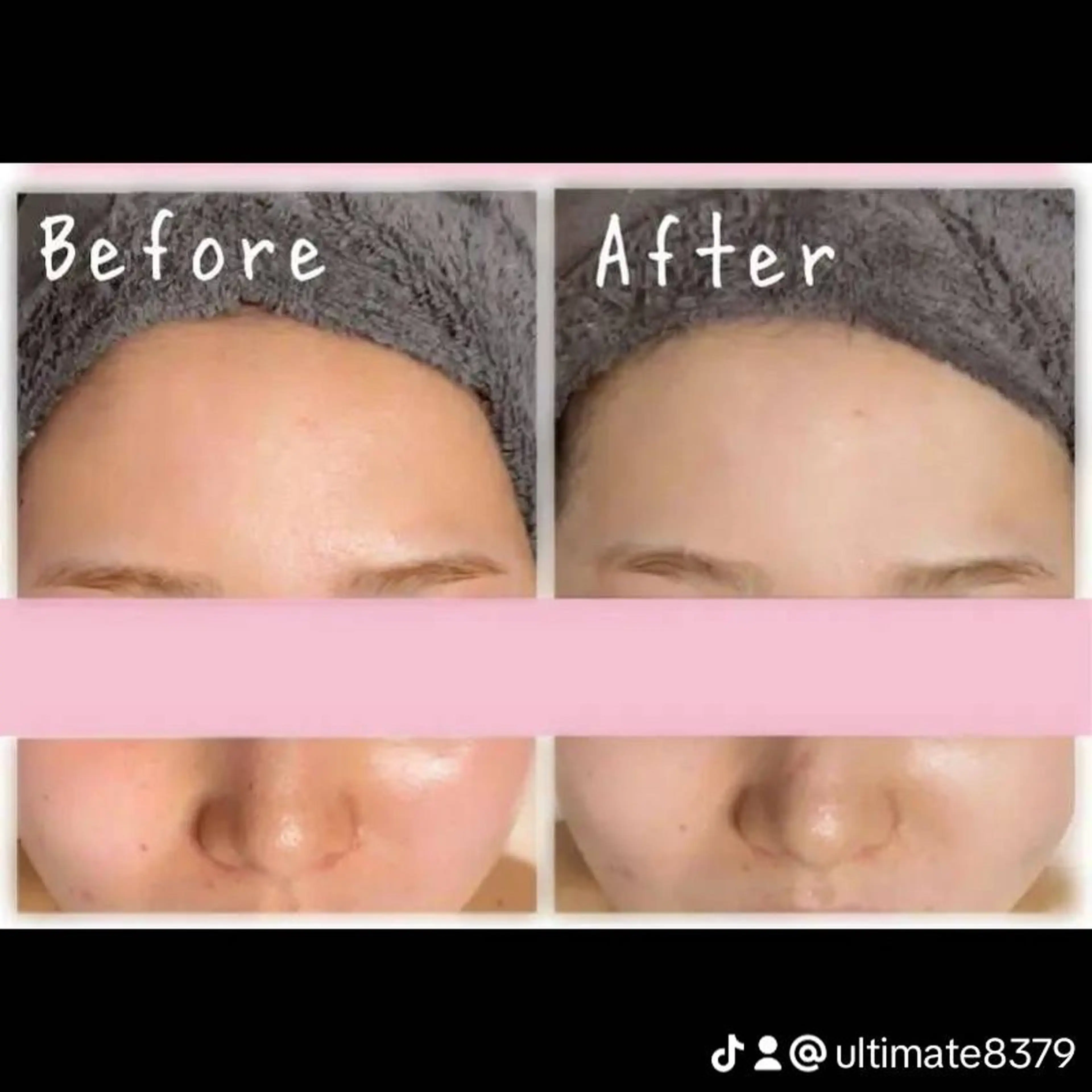 Ultimate 指名なしのエステ・リラクイメージ