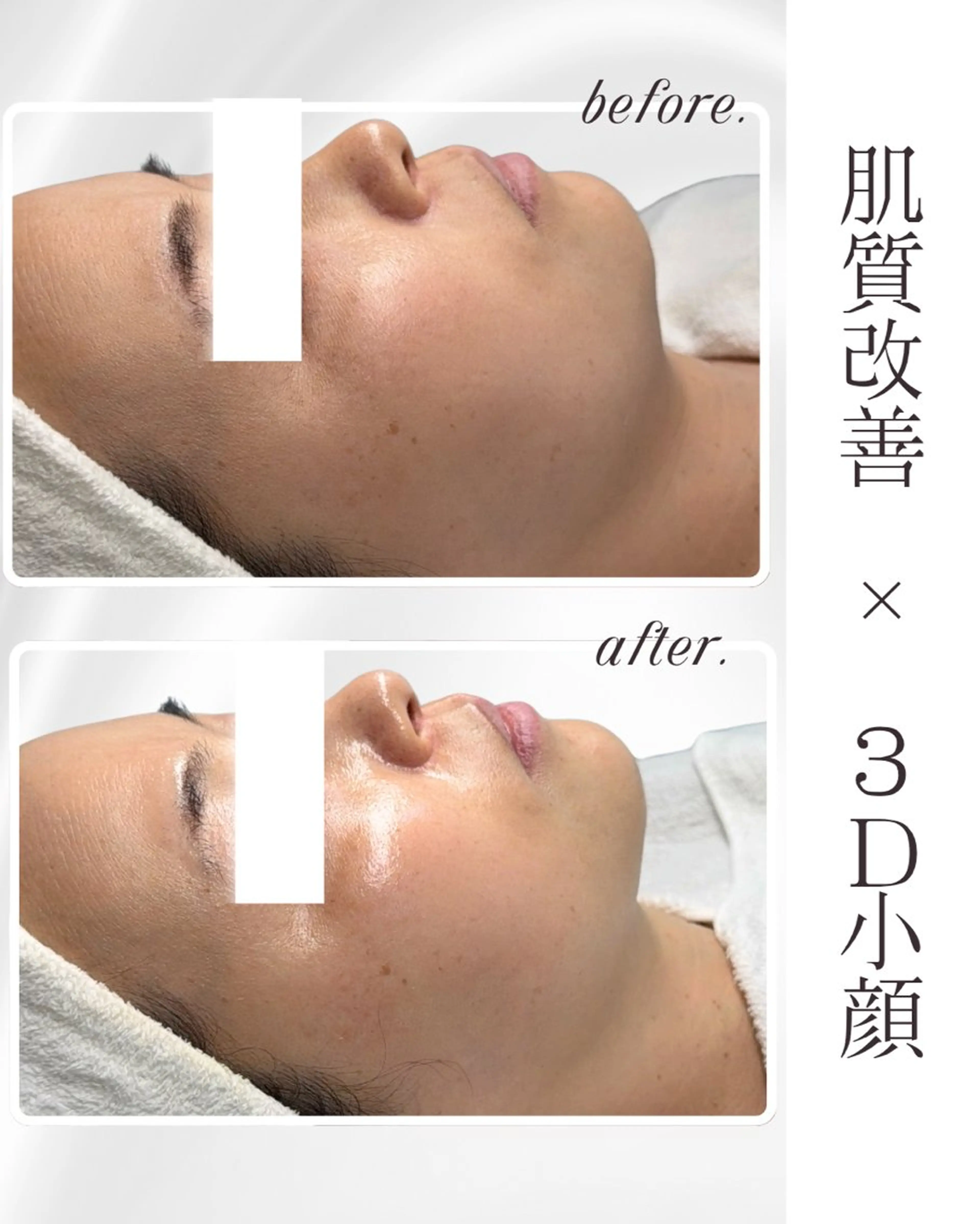 LiAm《美肌管理/ 小顔/脂肪ケア》のその他イメージ