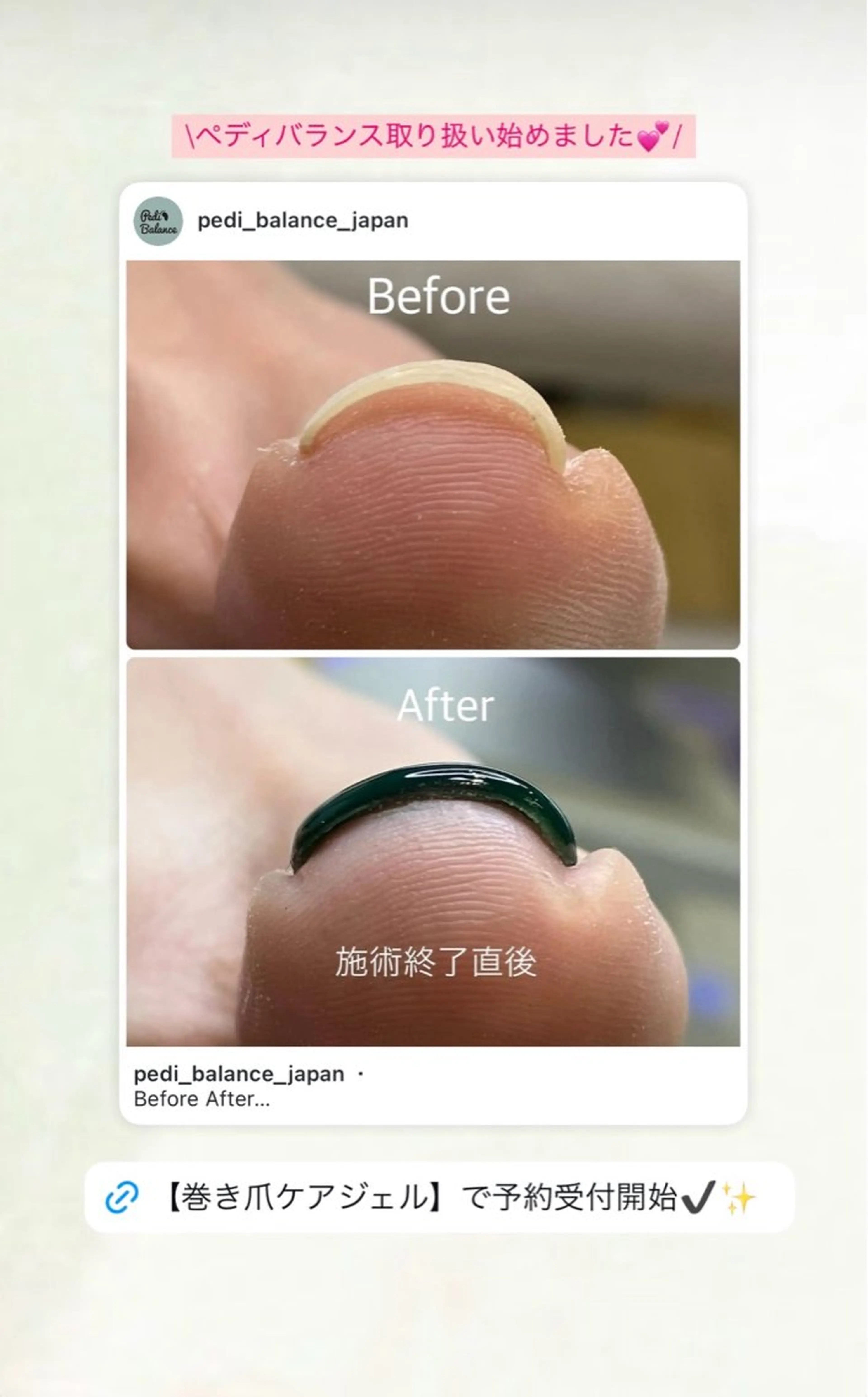 ネイル ジェルネイル フットネイル ZERO Nail Art Foot専用のネイルデザイン