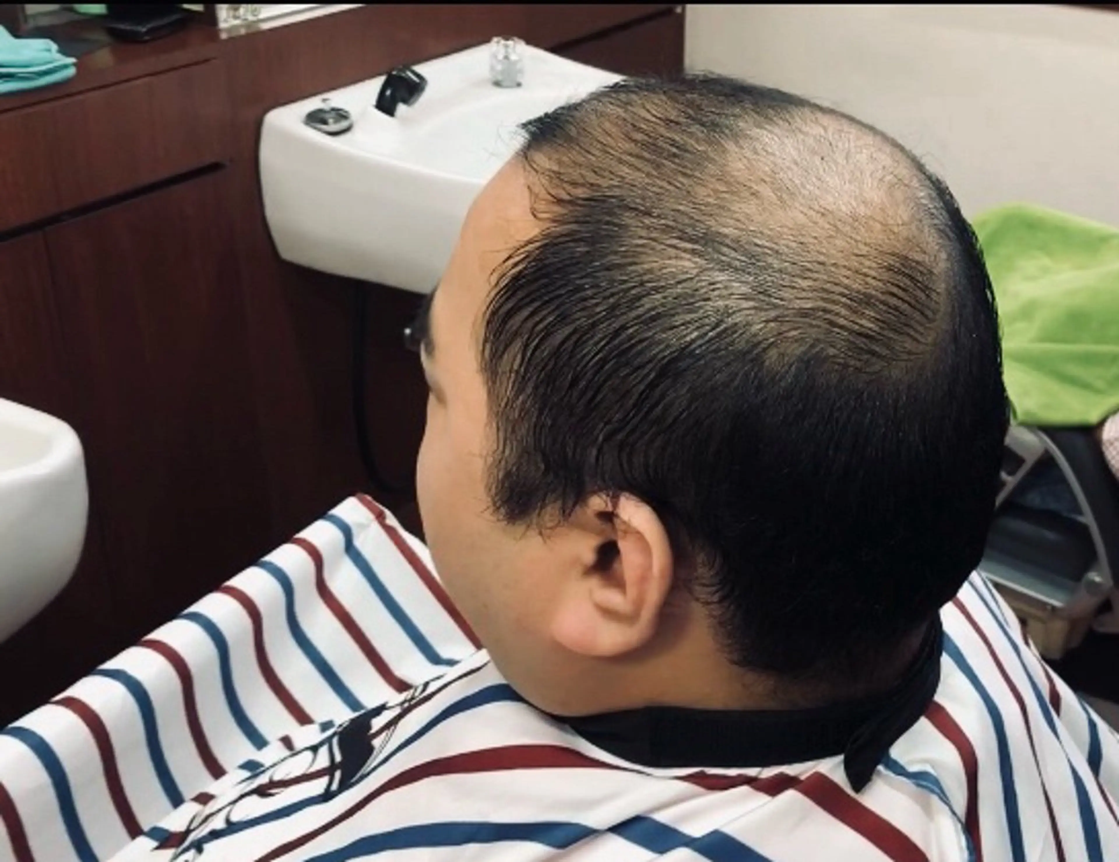 薄毛対応カットの写真