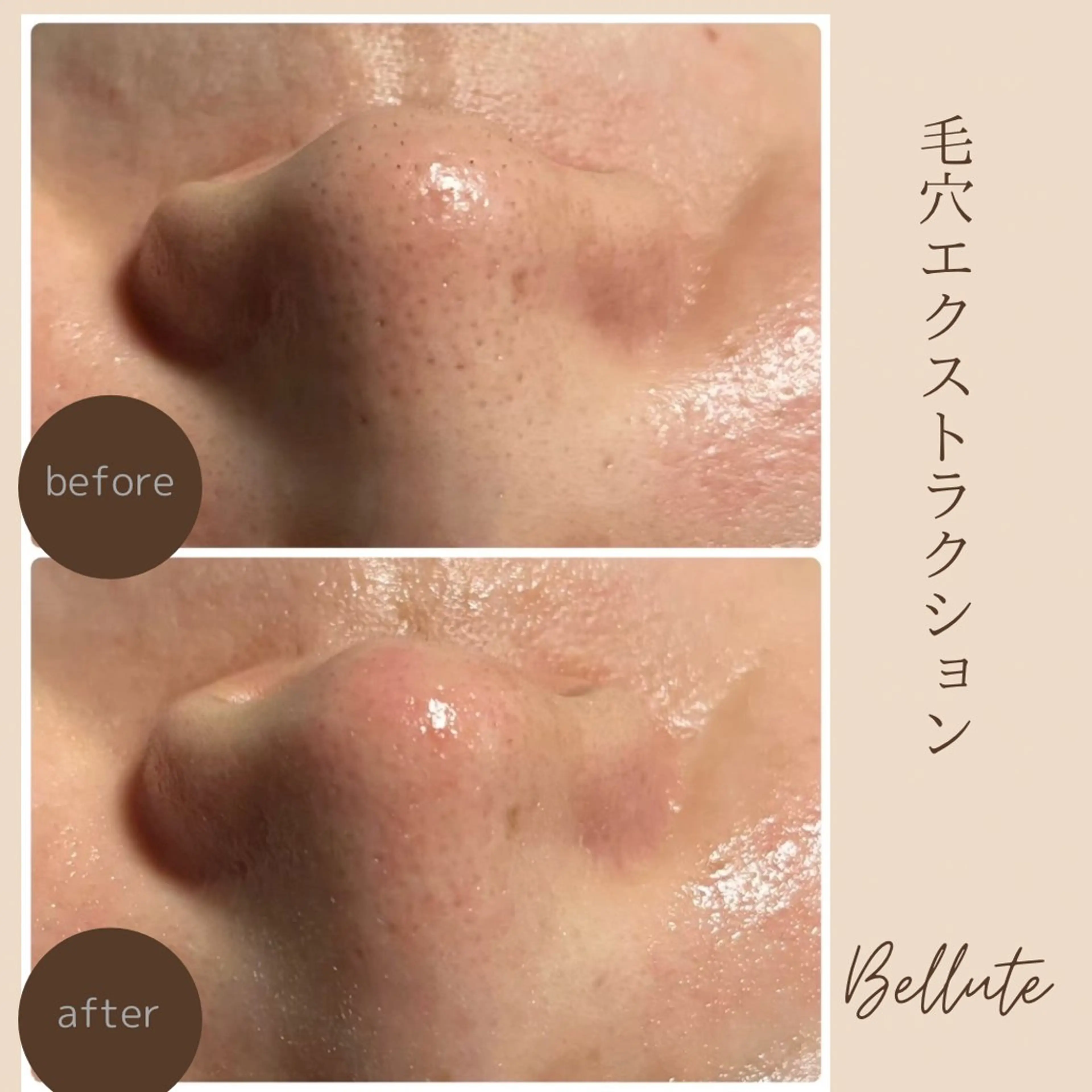 エステ リラク ピーリング専門店 Belluteのエステ・リラクイメージ