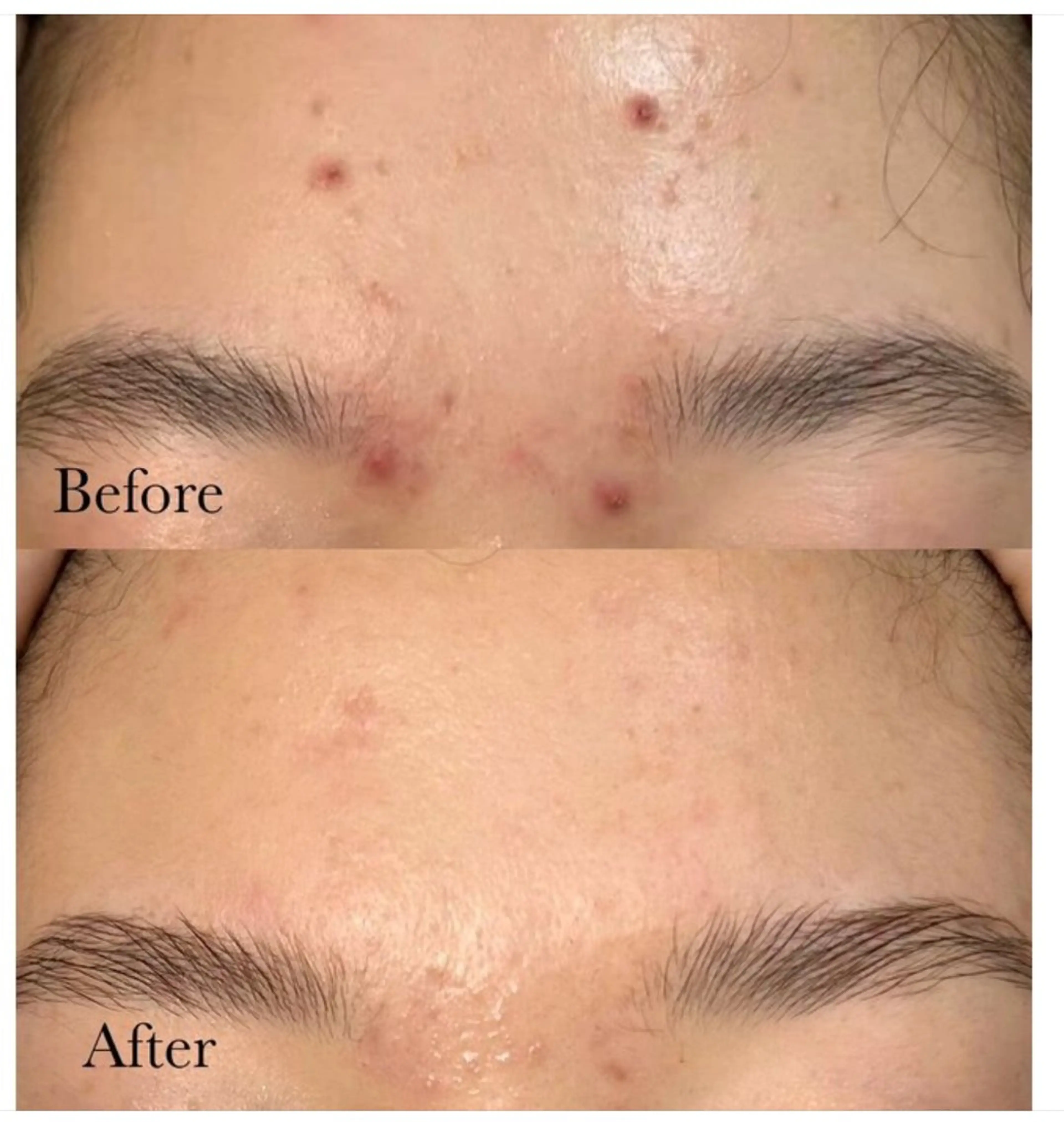 エステ リラク 愛維美水光美肌専門店 メンズレディースokのエステ・リラクイメージ