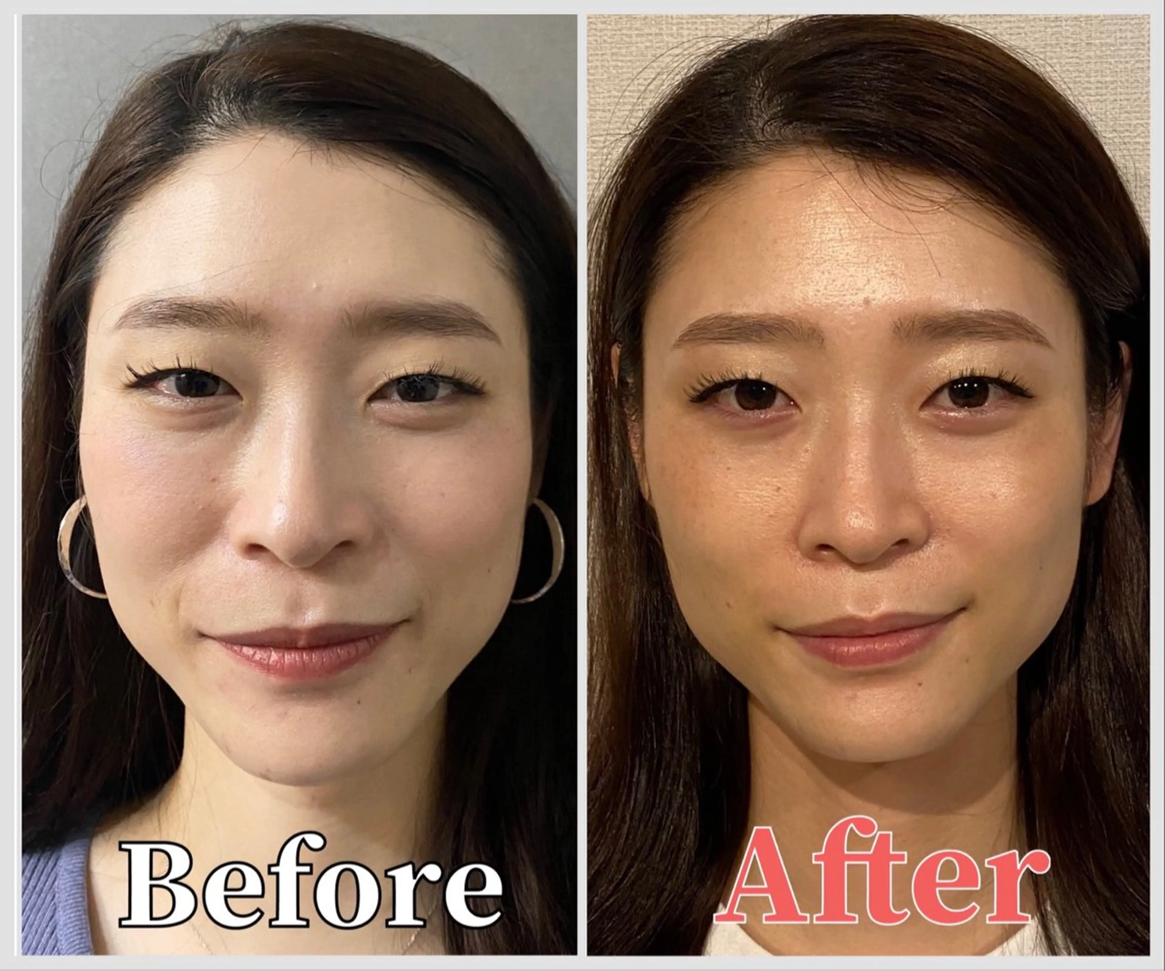 整体 LALUZ中目黒のその他イメージ