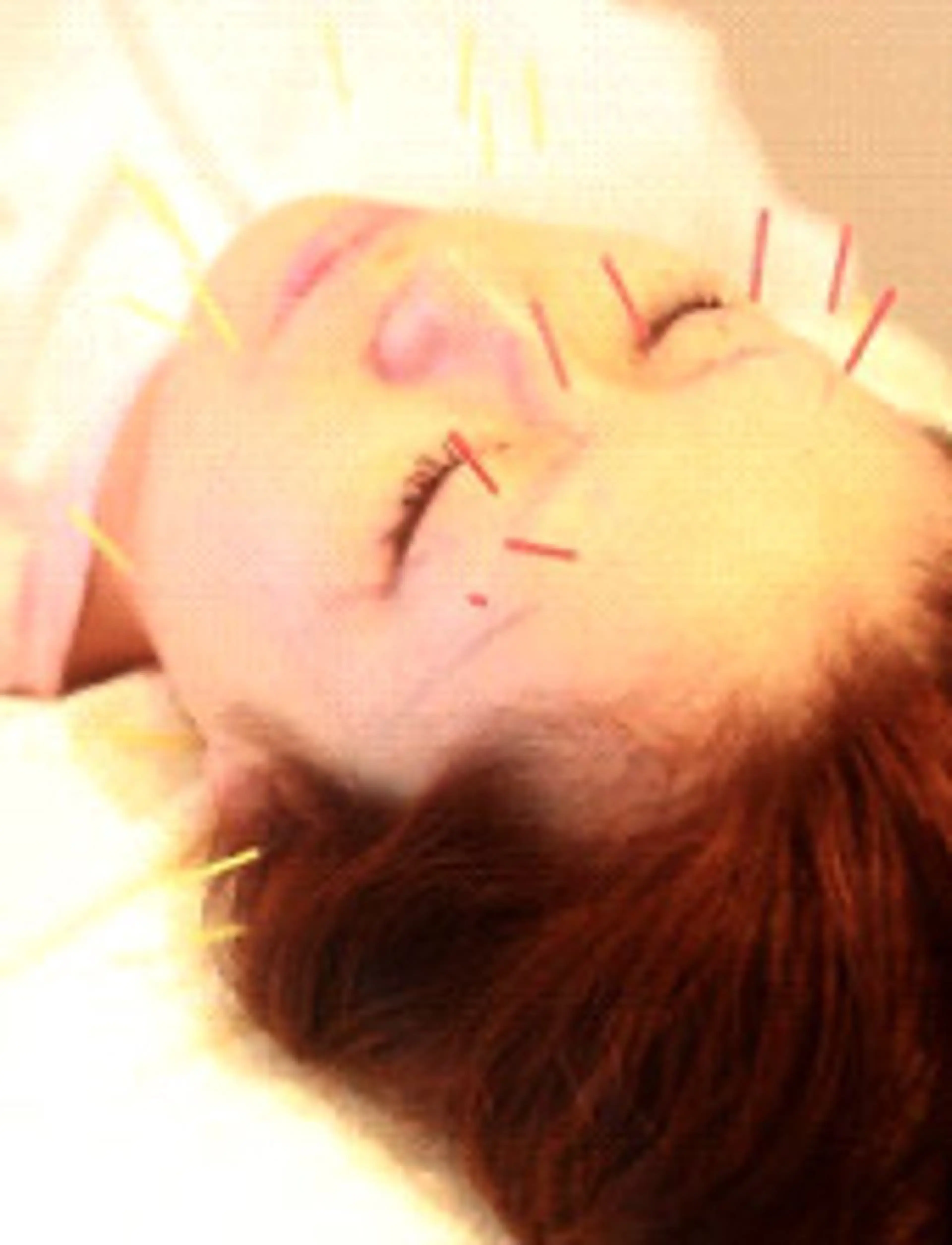 エステ リラク 近藤美容 はりきゅう院のエステ・リラクイメージ