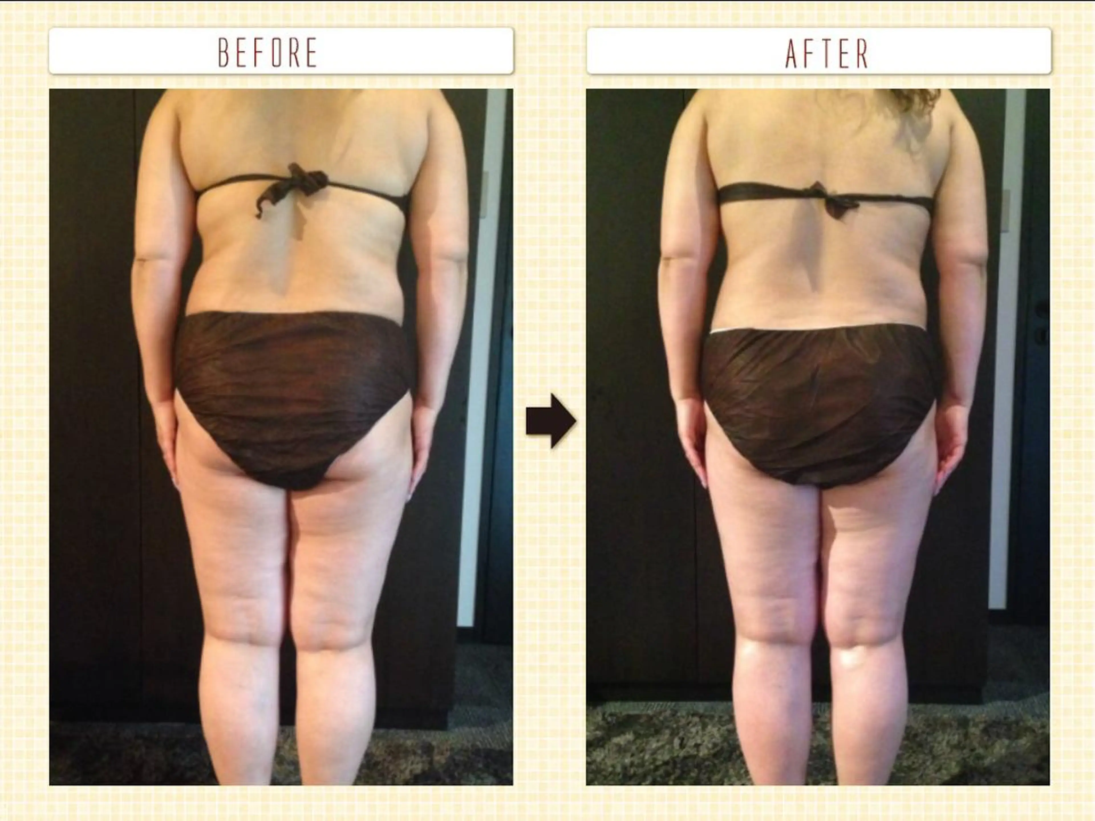 Morisugi Natsumiのエステ・リラクイメージ