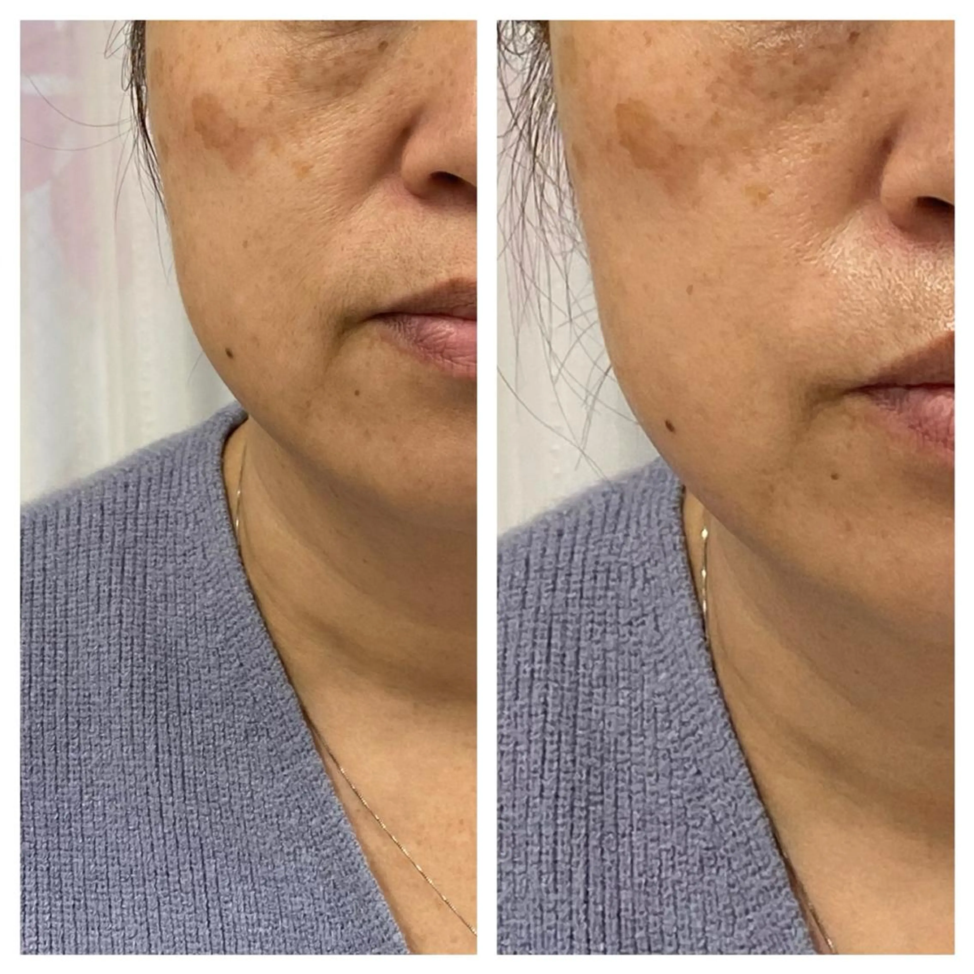 武藤 千裕のエステ・リラクイメージ