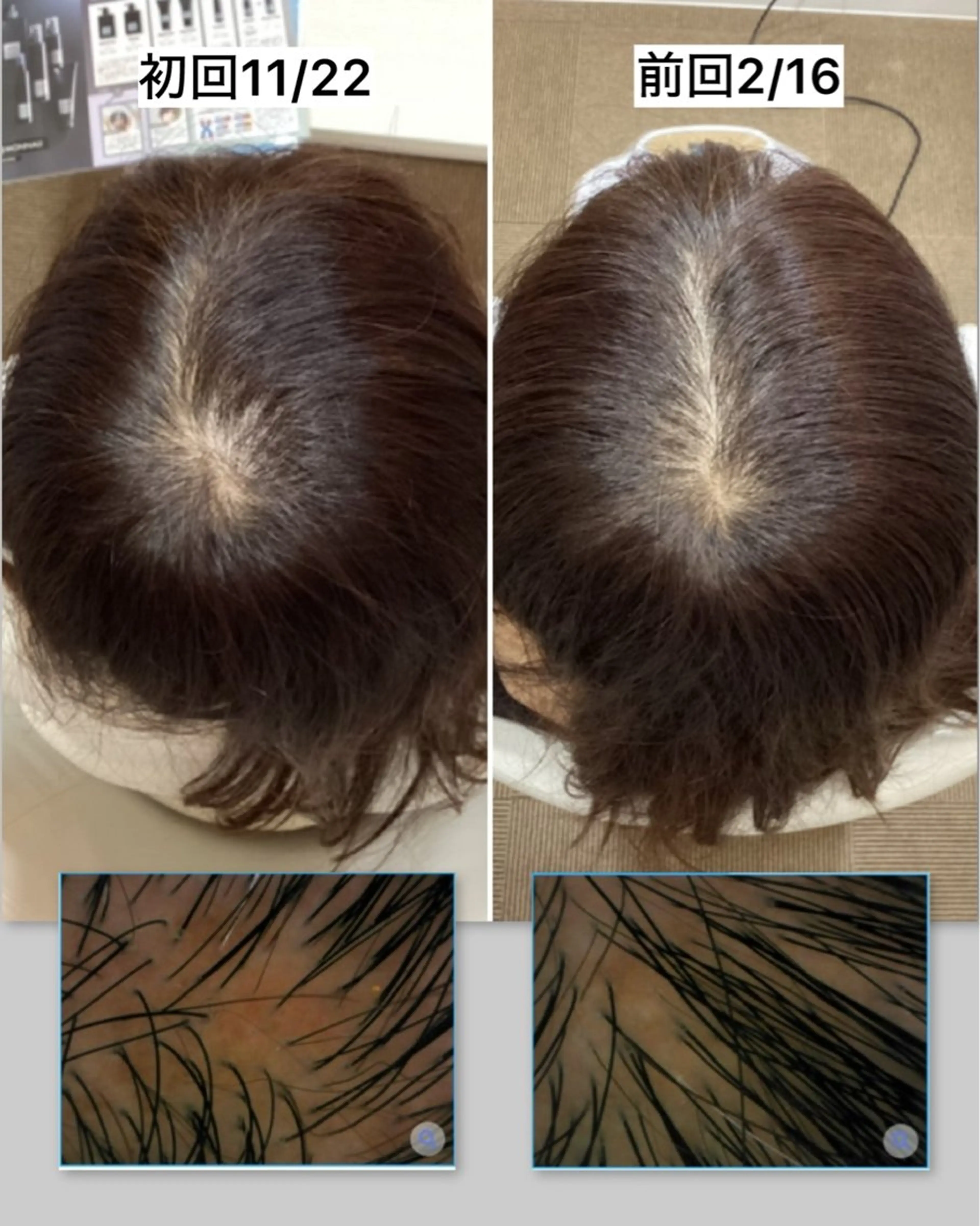 L＋ 育毛発毛サロン秋葉原のエステ・リラクイメージ