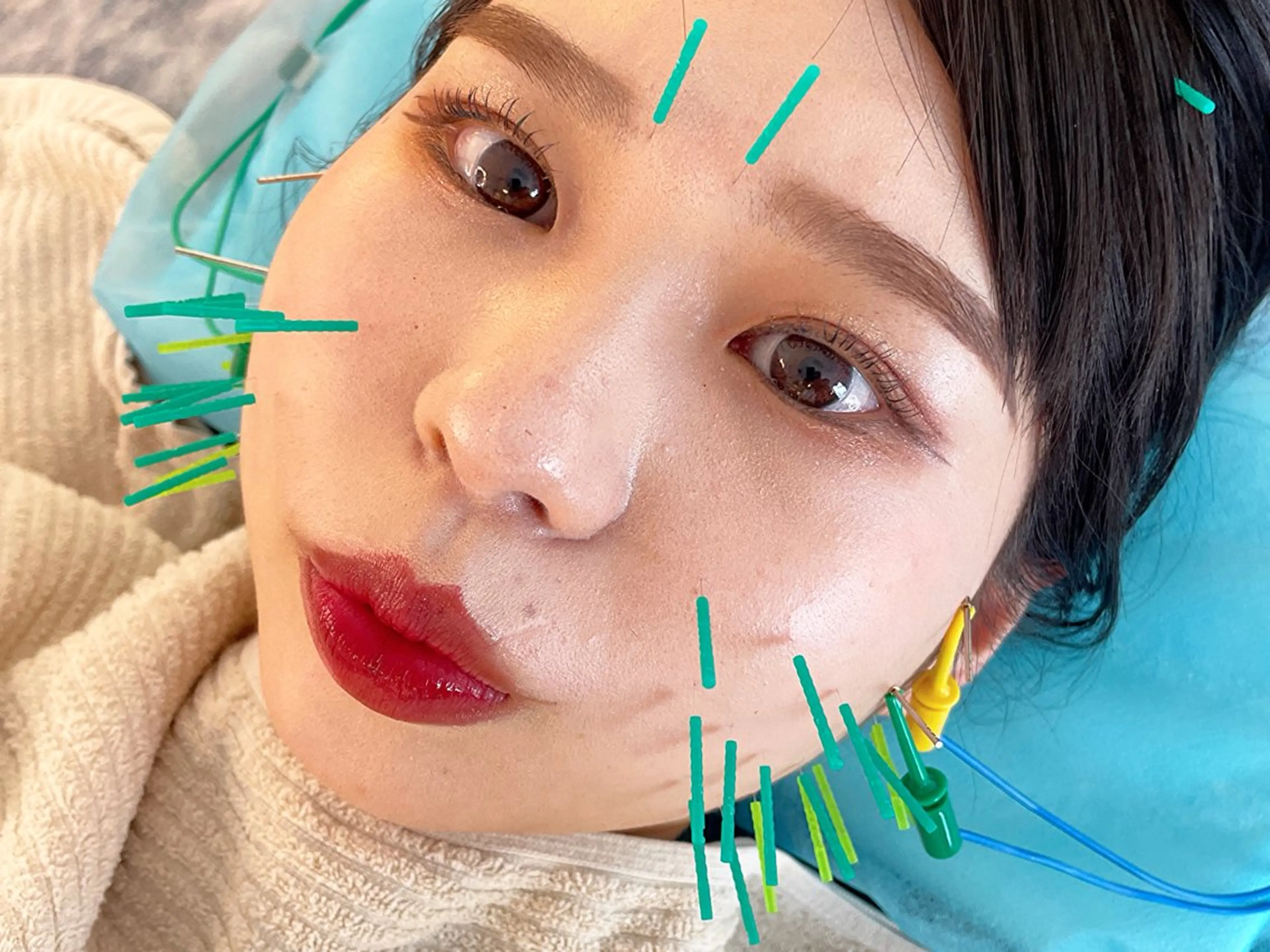 SALE❗️【ミニモ学割U24】イベント前にむくみOFF!小顔(マッサージ/ヘッドスパ)+EMS美容鍼の写真
