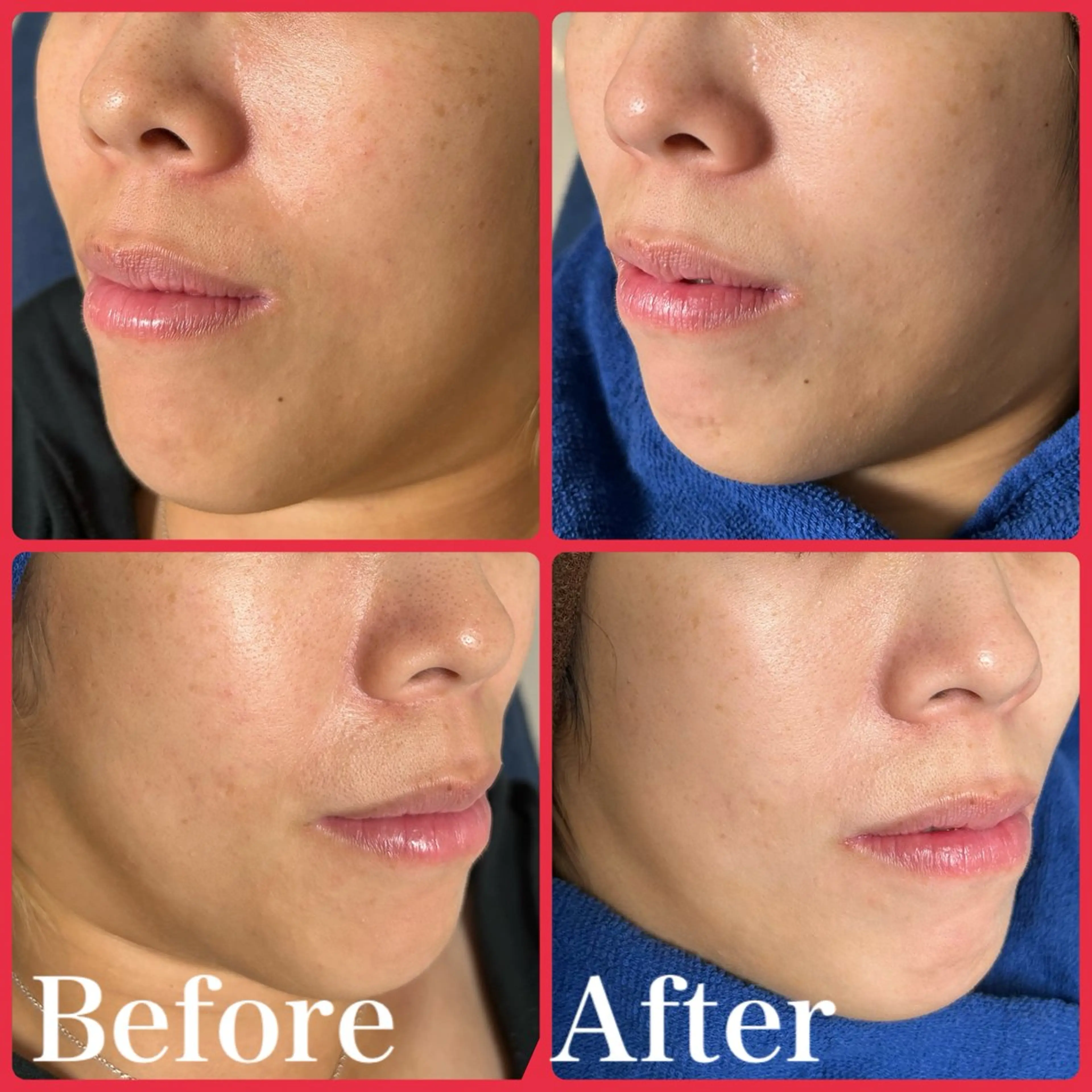 skin make salon -Olu's-所属・毛穴・肌質改善サロン ✨Tomaのその他イメージ