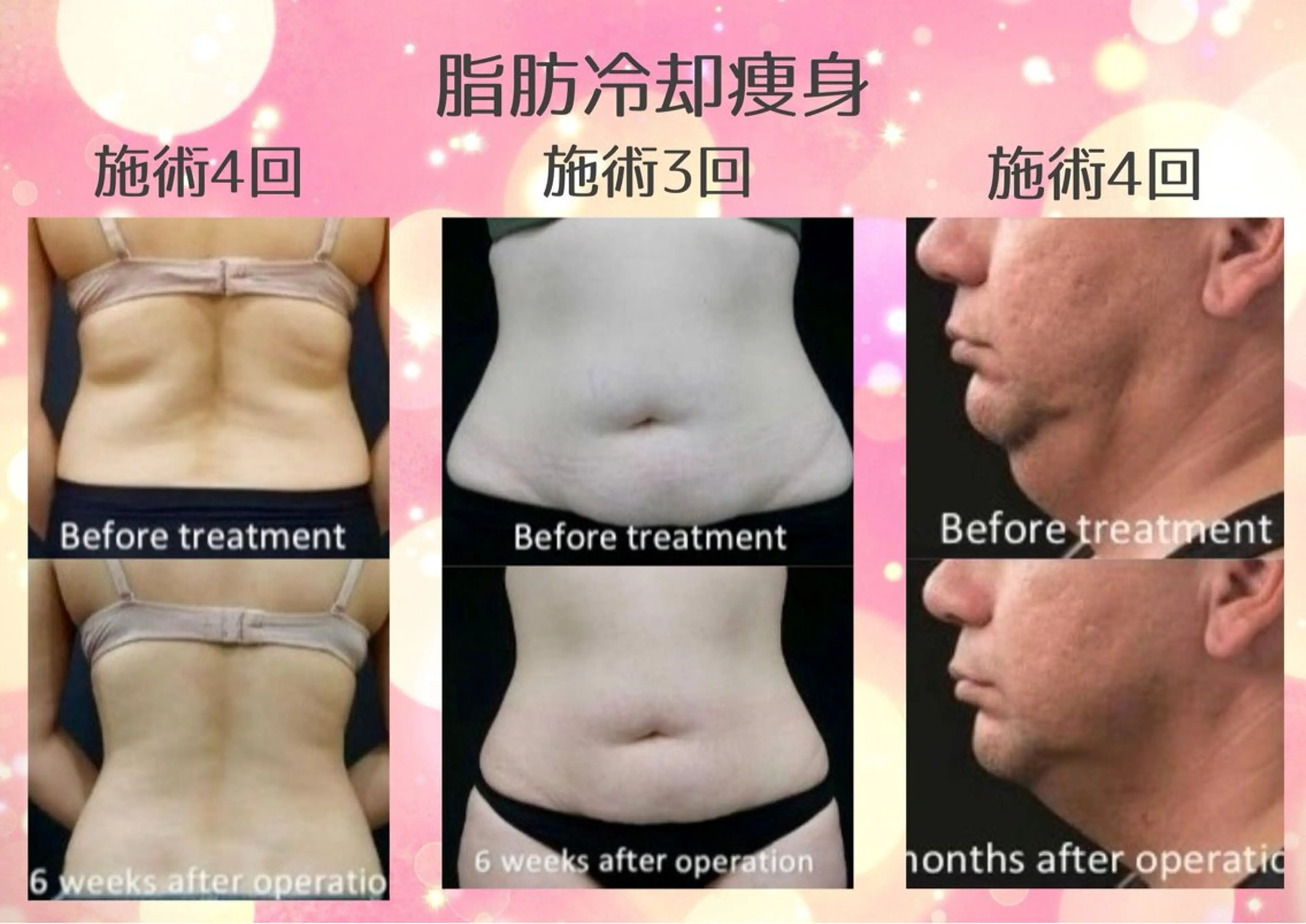 マツエク・マツパ エステ リラク 愛維美水光美肌専門店 メンズレディースokのエステ・リラクイメージ