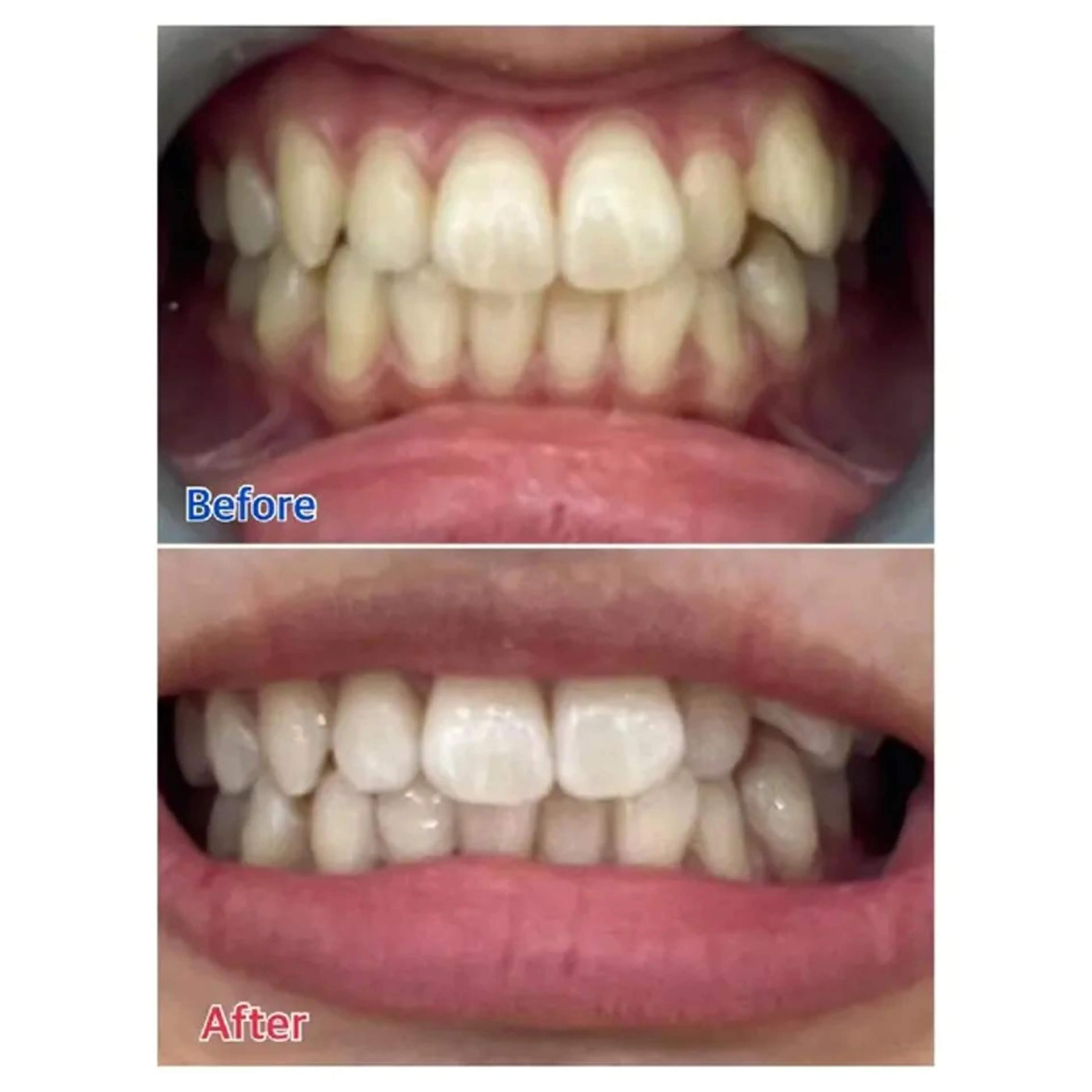 M渋谷 ホワイトニングのエステ・リラクイメージ