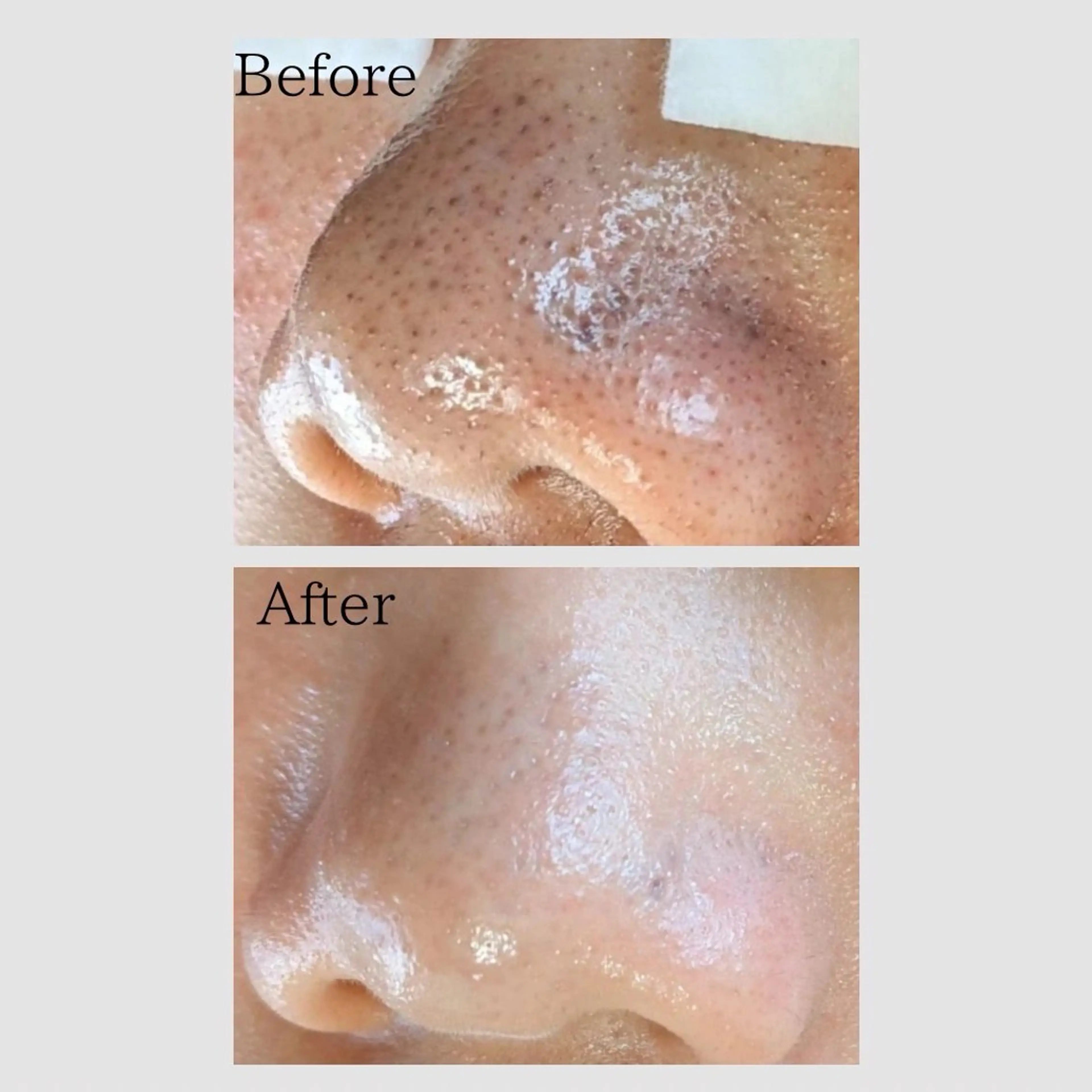 エステ リラク 韓国肌管理 【毛穴専科】のエステ・リラクイメージ