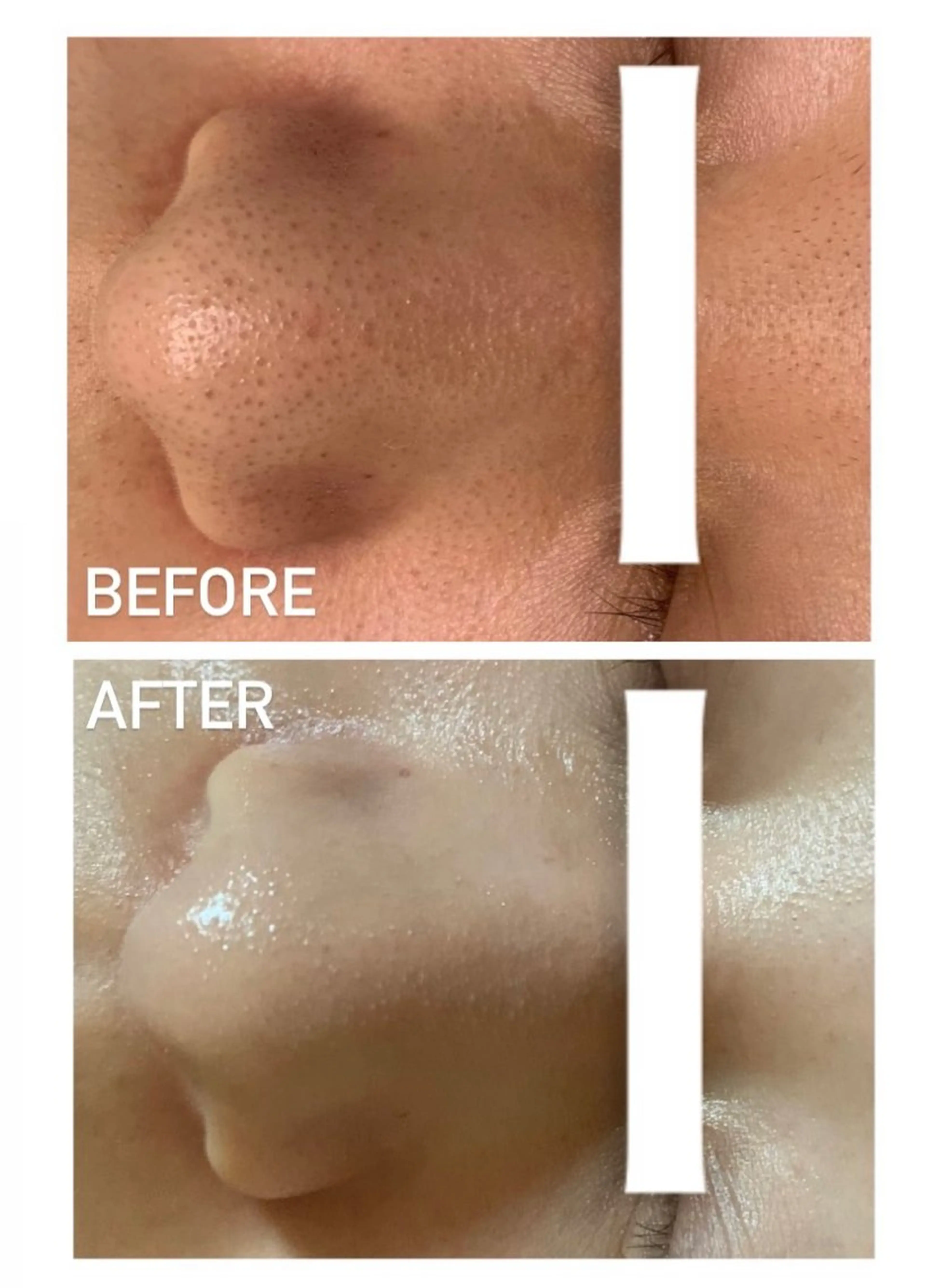 ナリスビューティサロンあべの所属・肌質改善/ツヤ肌作り /松本杏奈のエステ・リラクイメージ