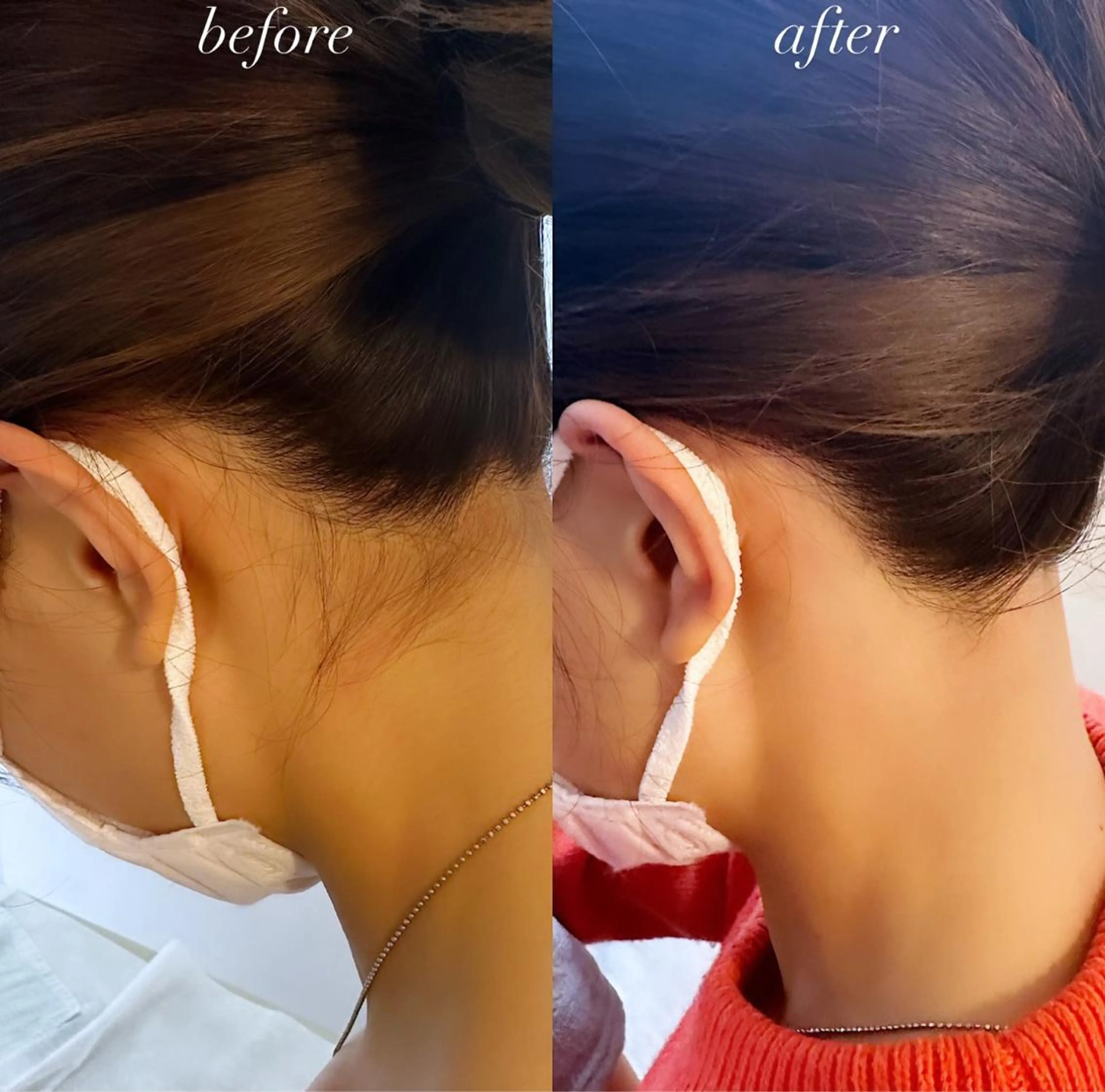 うなじ脱毛/美肌脱毛 LABELのエステ・リラクイメージ