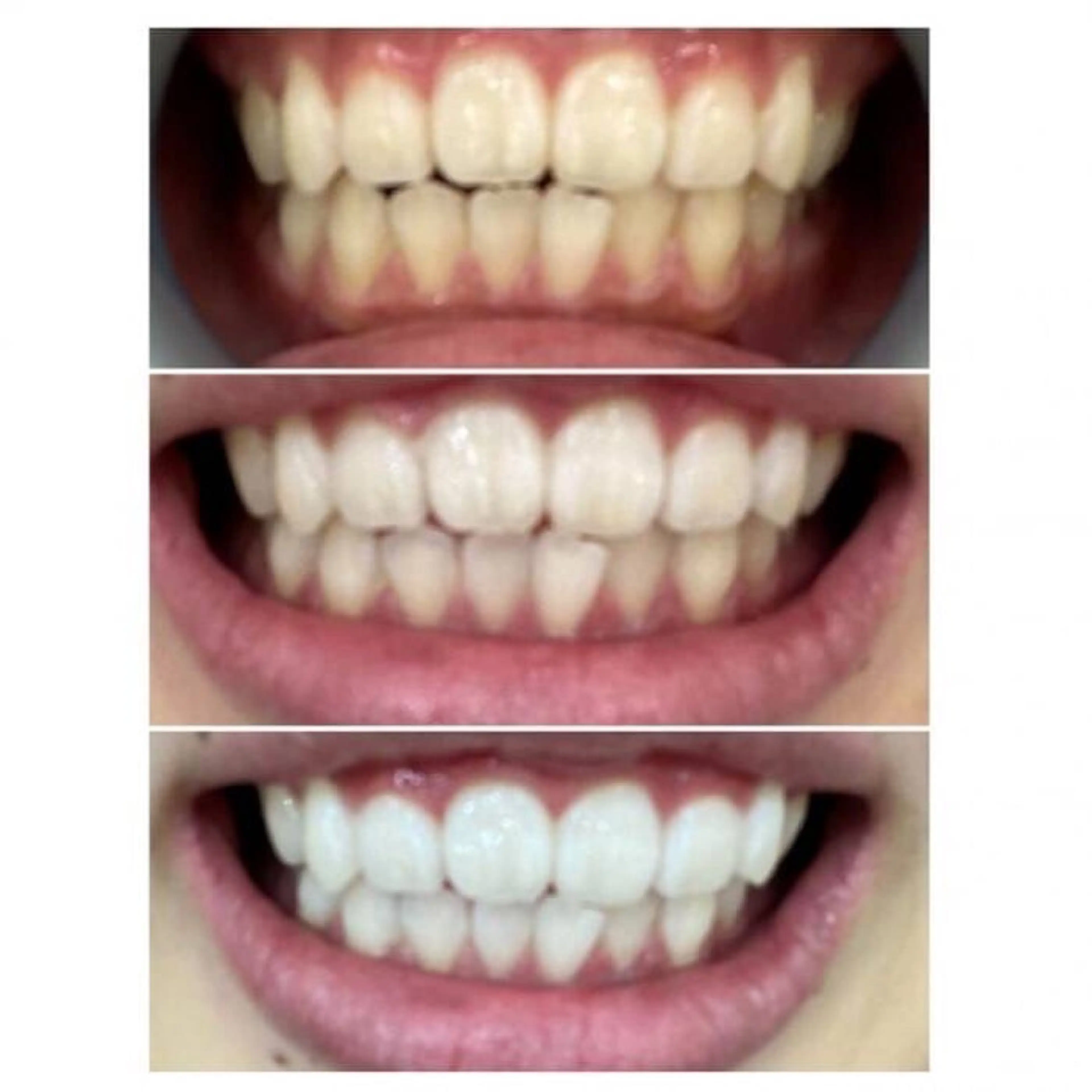 Ｍ渋谷 ホワイトニングのエステ・リラクイメージ