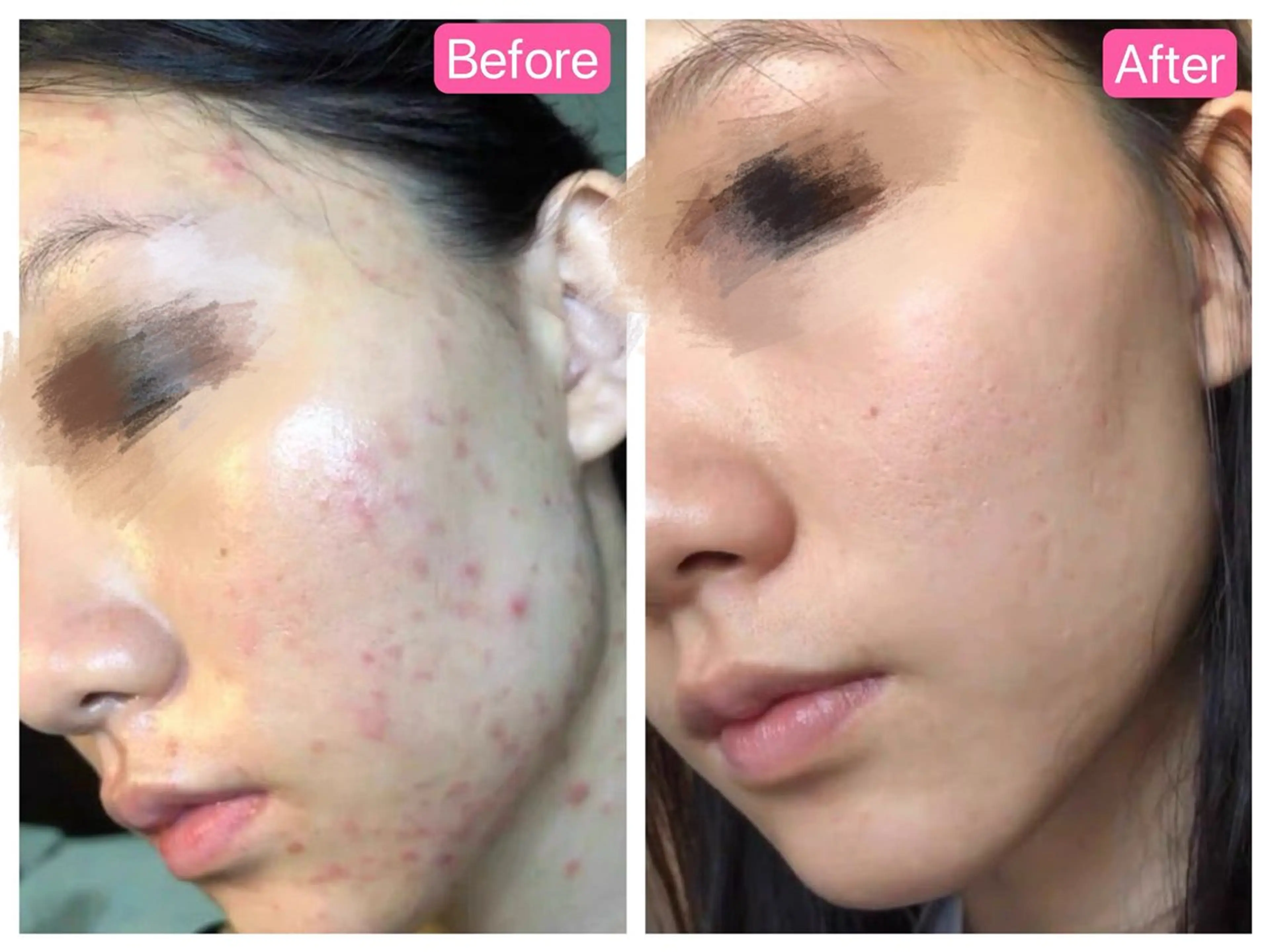 Nature Souce毛穴専門店のその他イメージ