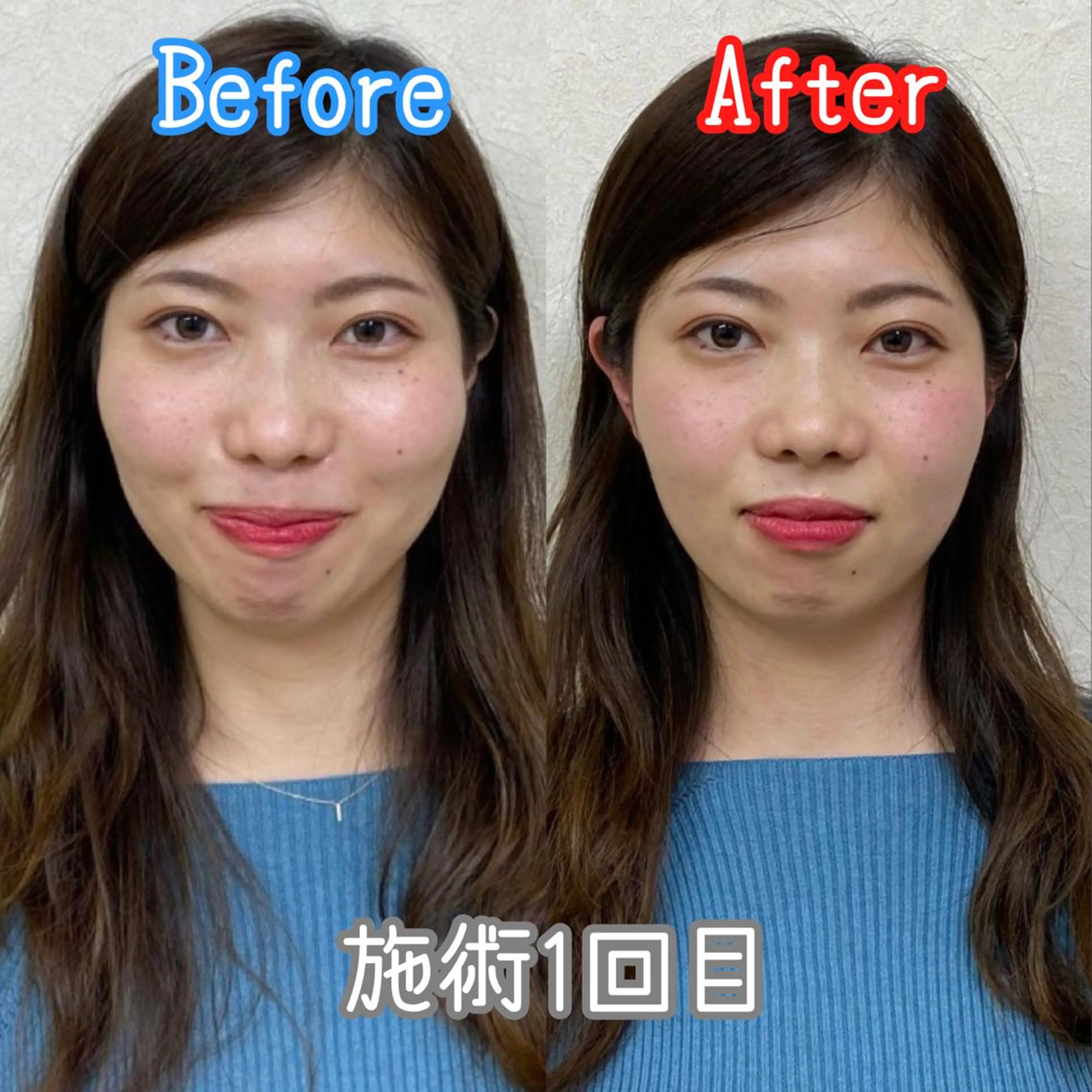 整体 LALUZ中目黒のその他イメージ