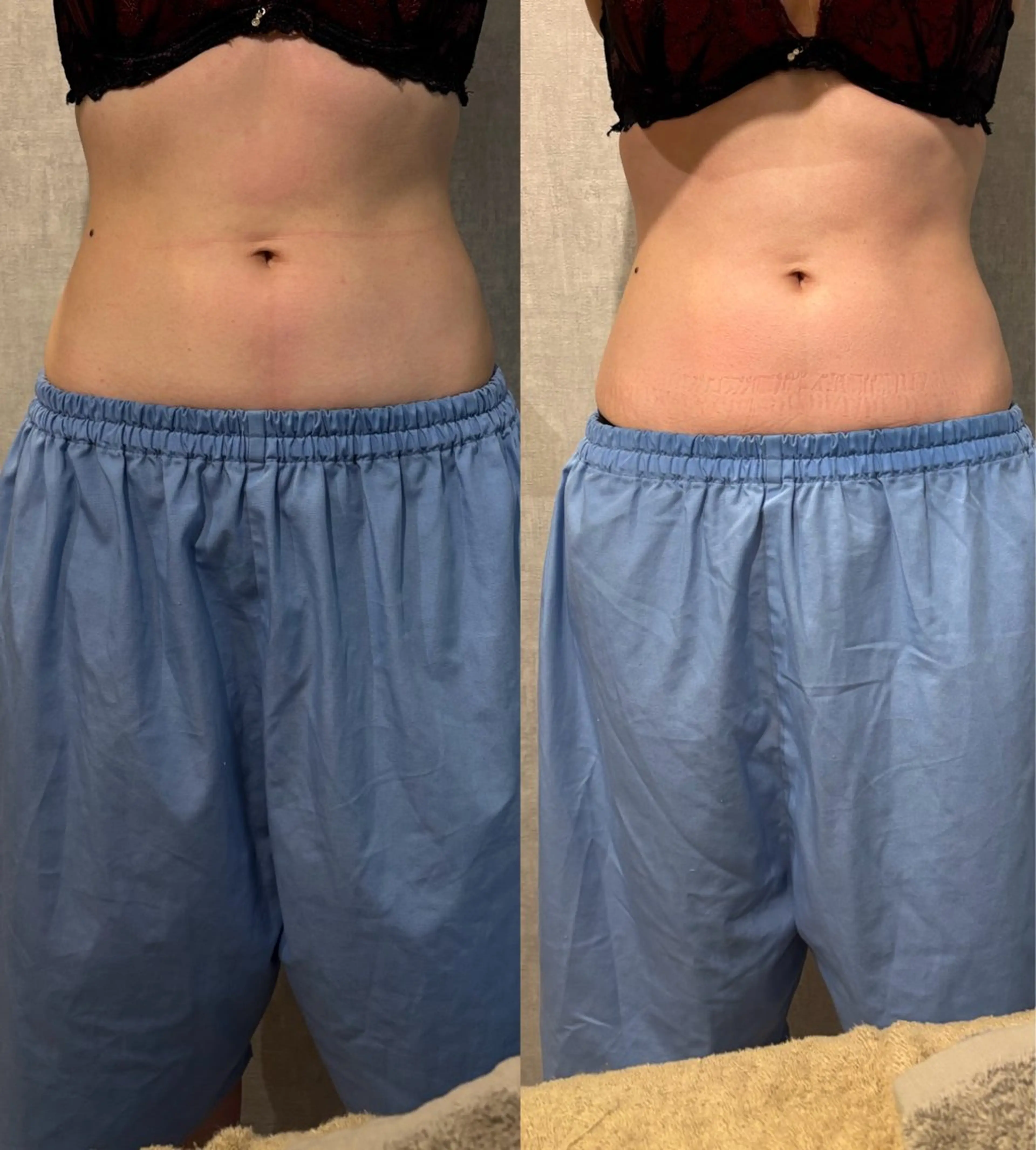 エステ リラク 腸活サポート みなみののエステ・リラクイメージ