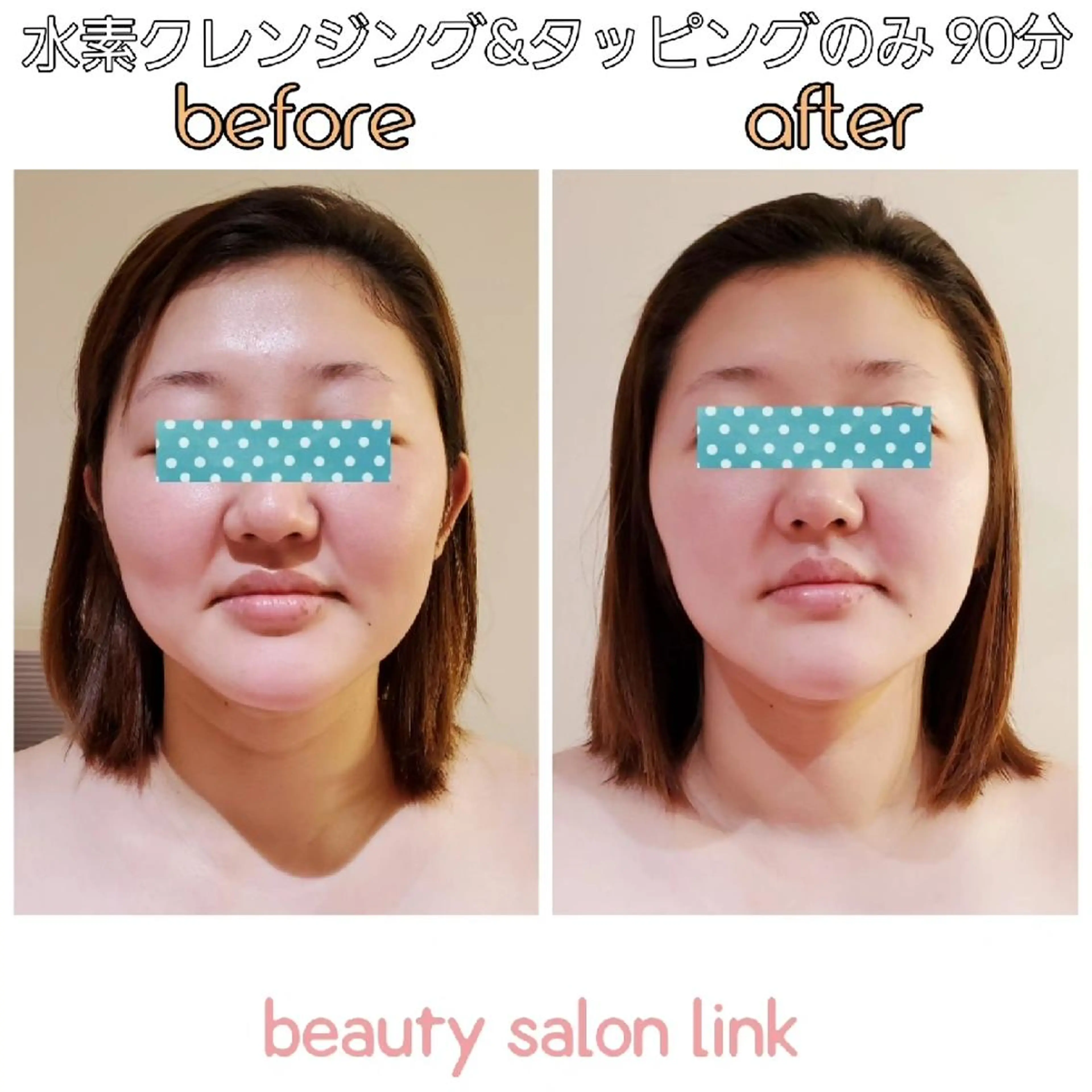 エステ beauty salon  link所属・水素エステと美容脱毛 salon Linkのエステ・リラクイメージ