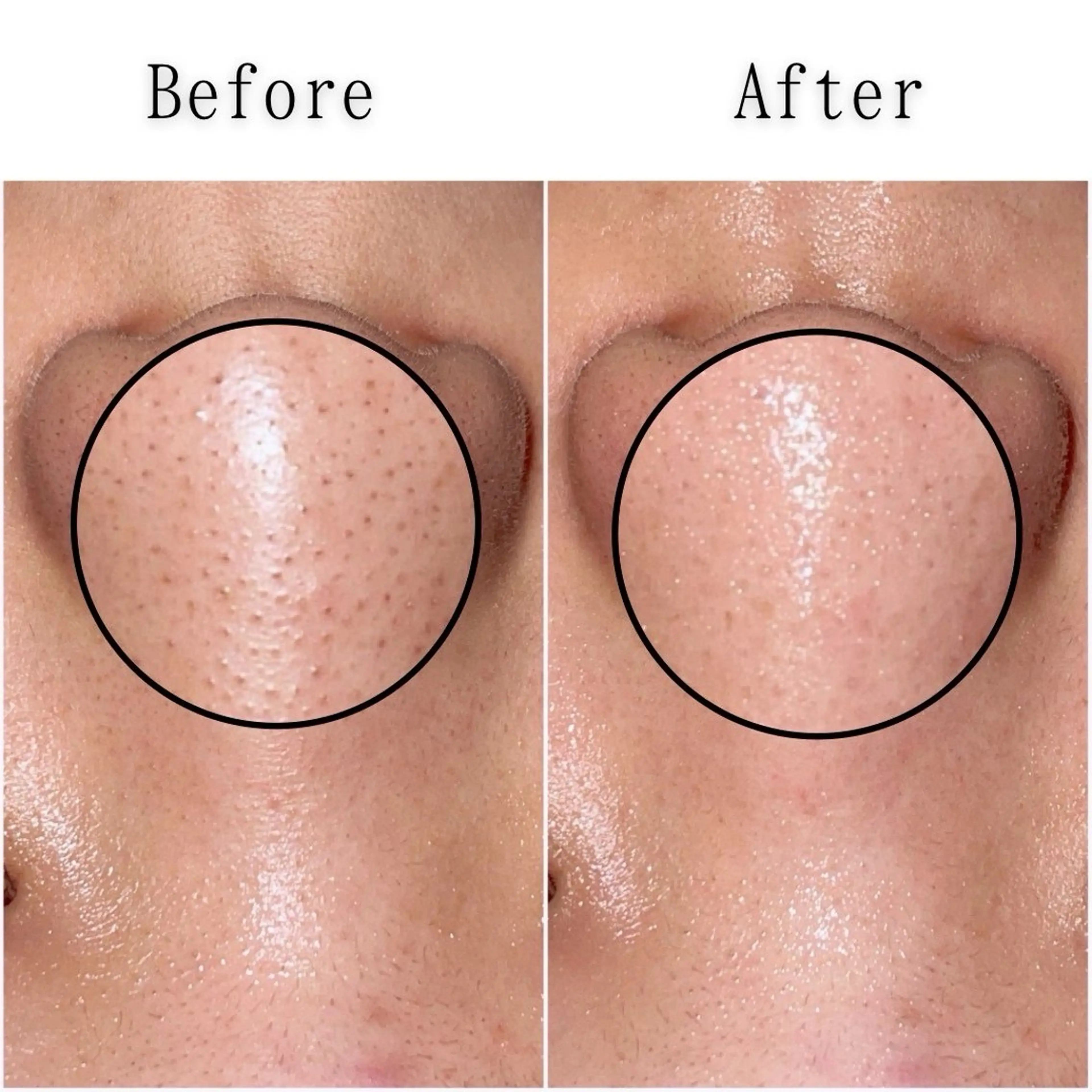 エステ シミ・毛穴専門店 /gracia 安藤のエステ・リラクイメージ