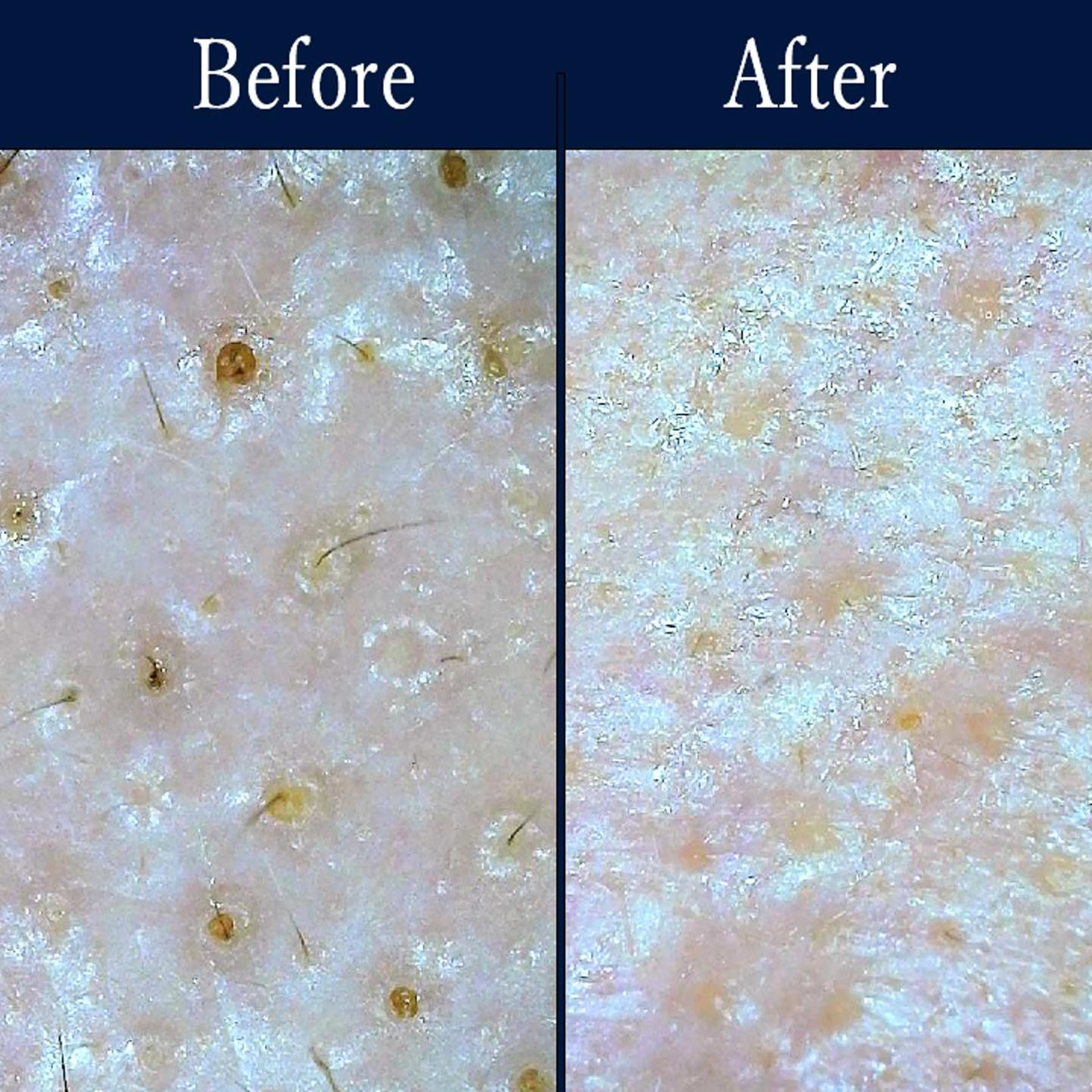 エステ リラク 【美容鍼・小顔鍼】 鍼灸師　吉田洋美のエステ・リラクイメージ