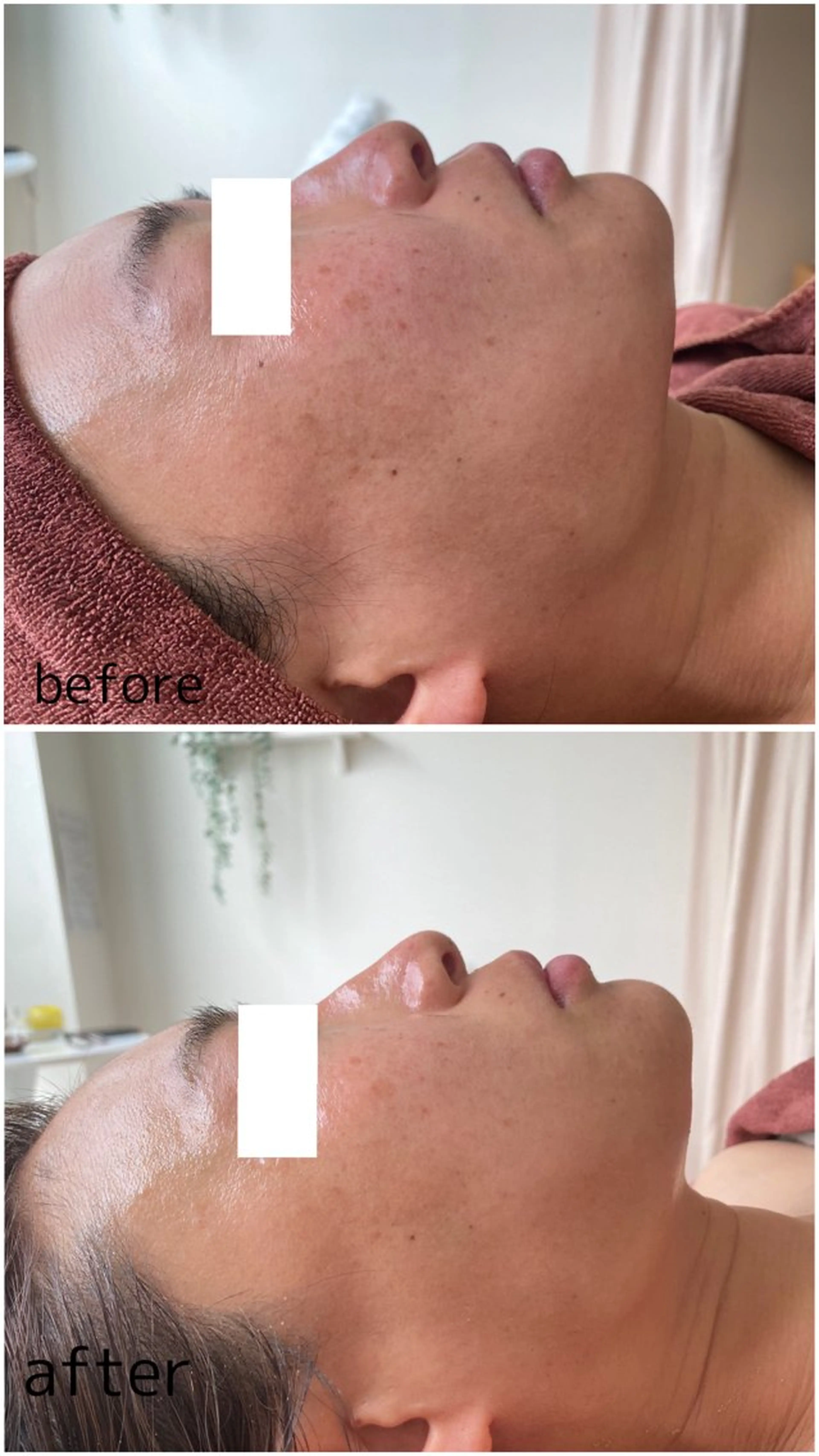 エステ 肌質改善ワックス専門 yukiのエステ・リラクイメージ