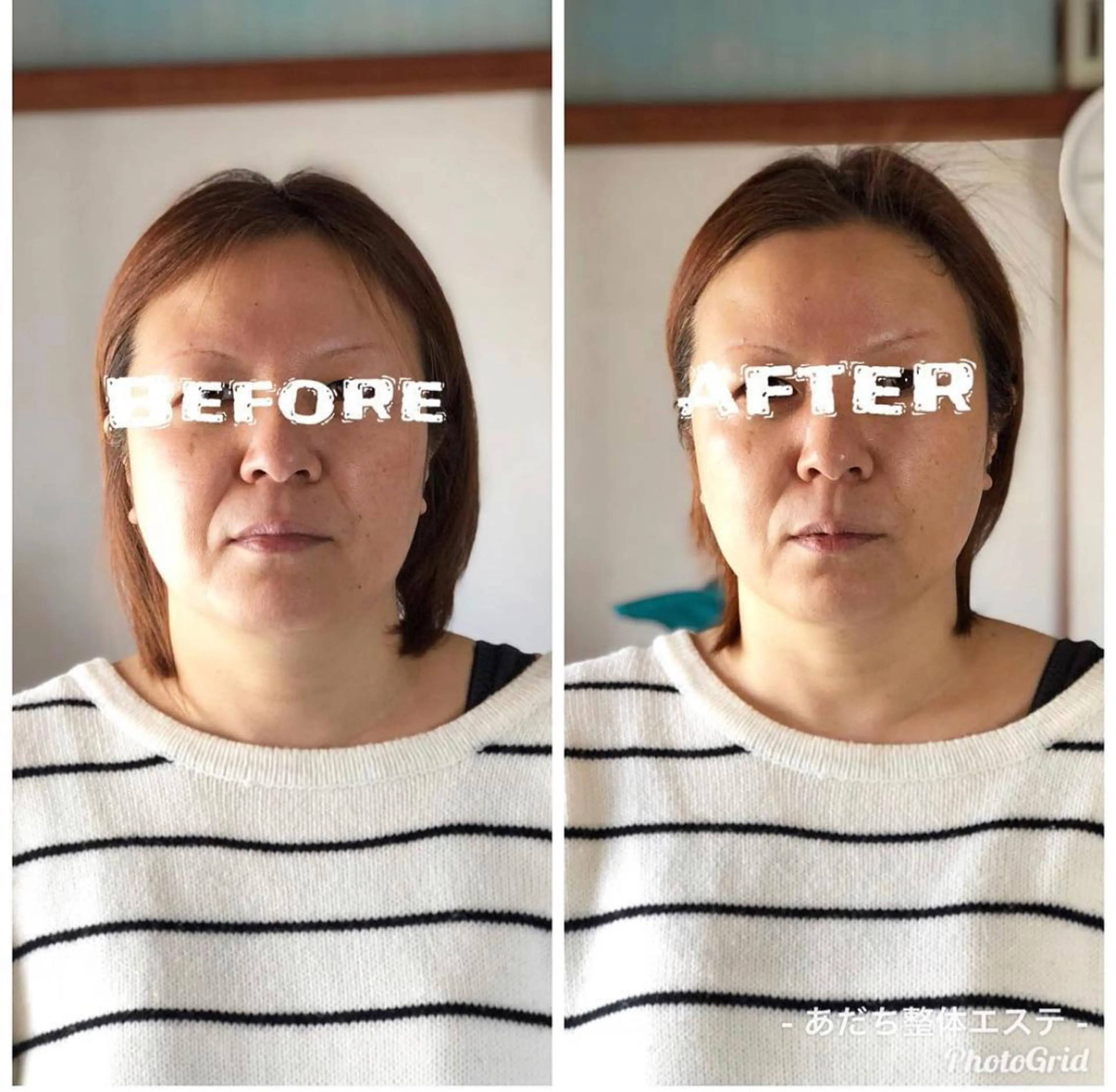 あだち整体エステ 首肩背中のゆるめぐのエステ・リラクイメージ