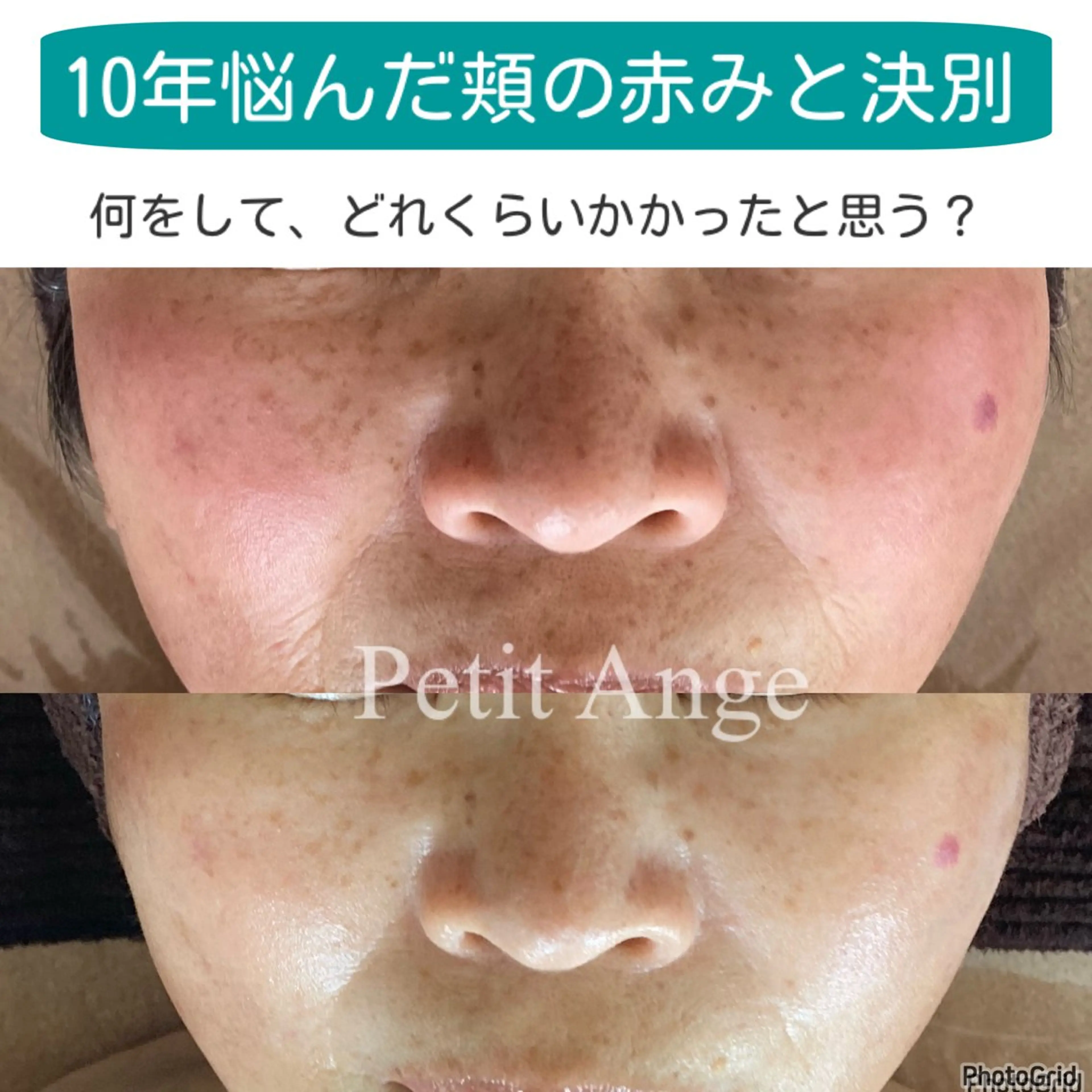 エステ リラク 艶肌&小顔リフト❤︎ プチアンジェ茅ヶ崎のエステ・リラクイメージ