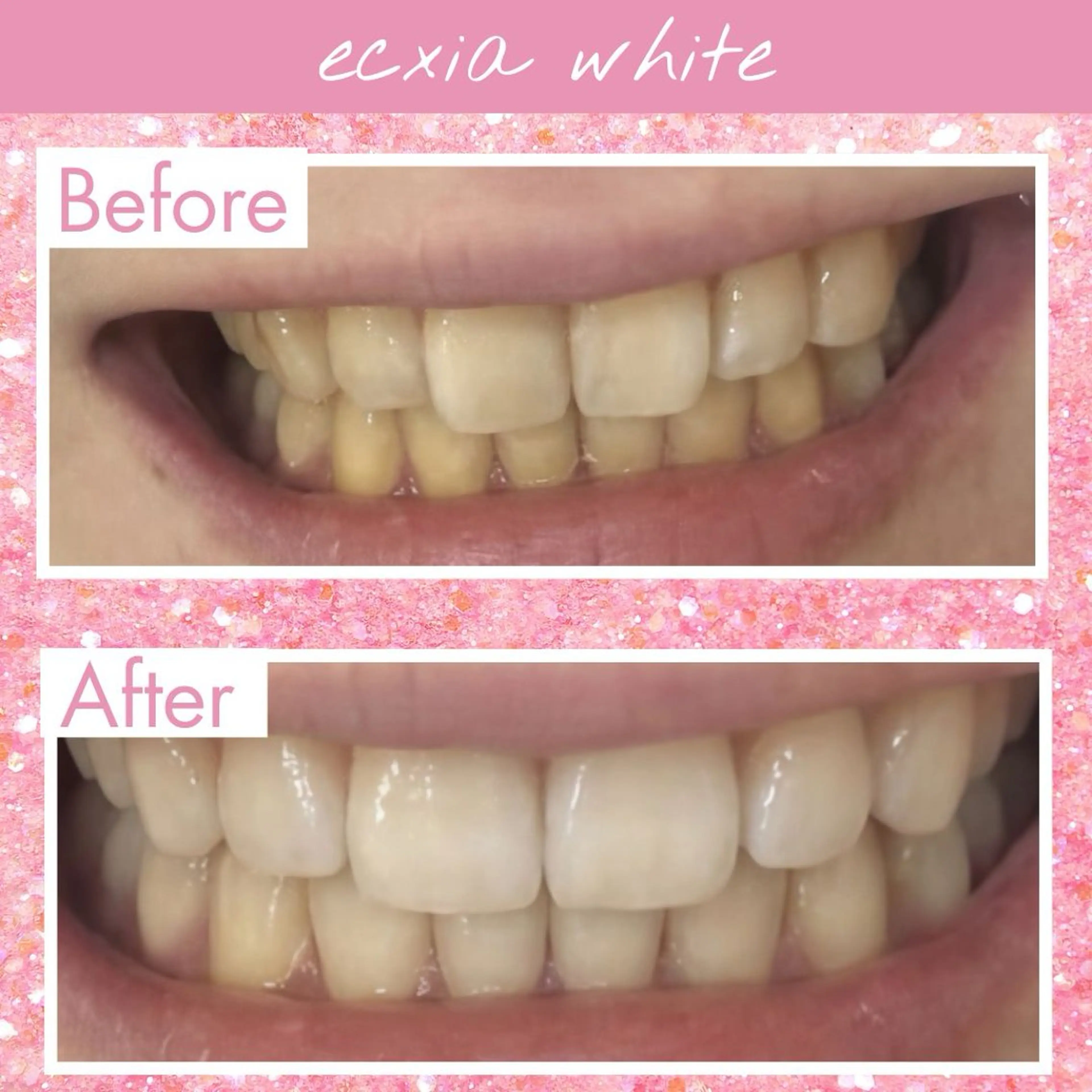 セルフホワイトニング エクシア宮崎花ヶ島店のその他イメージ