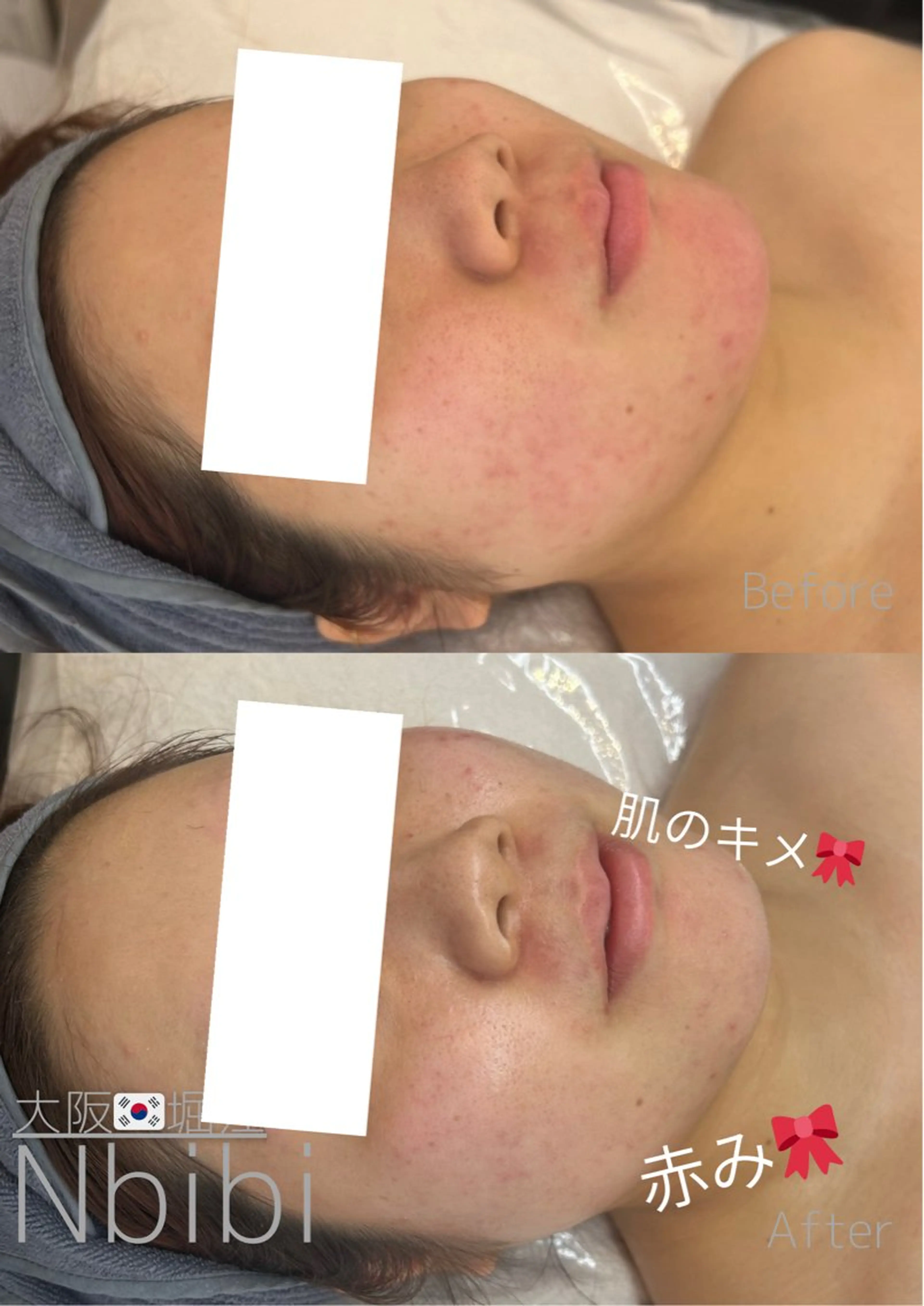 エステ 韓国🇰🇷価格 サロン_Nbibiの眉毛・アイブロウイメージ