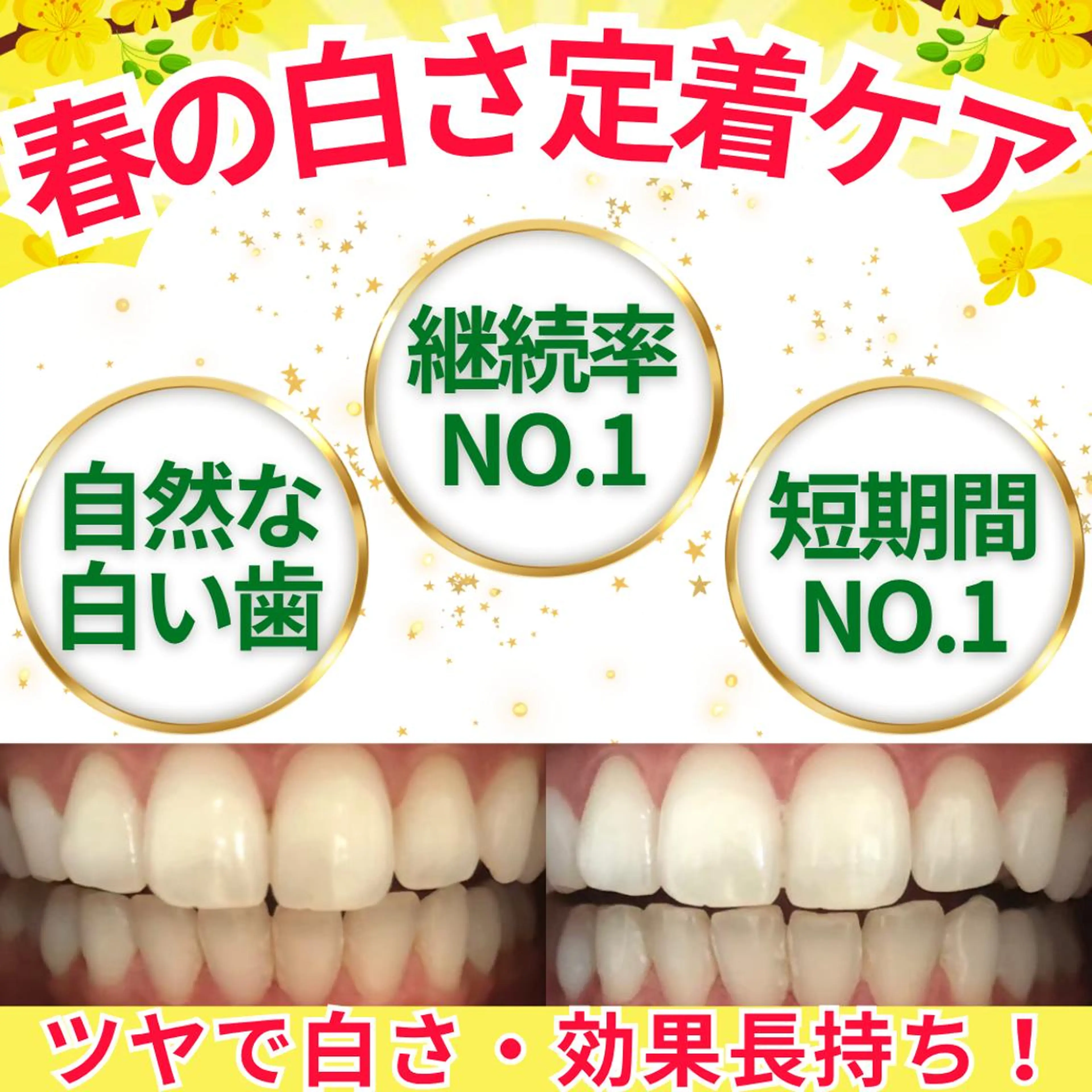 その他 LBSホワイトニング 💎梅田店公式のその他イメージ