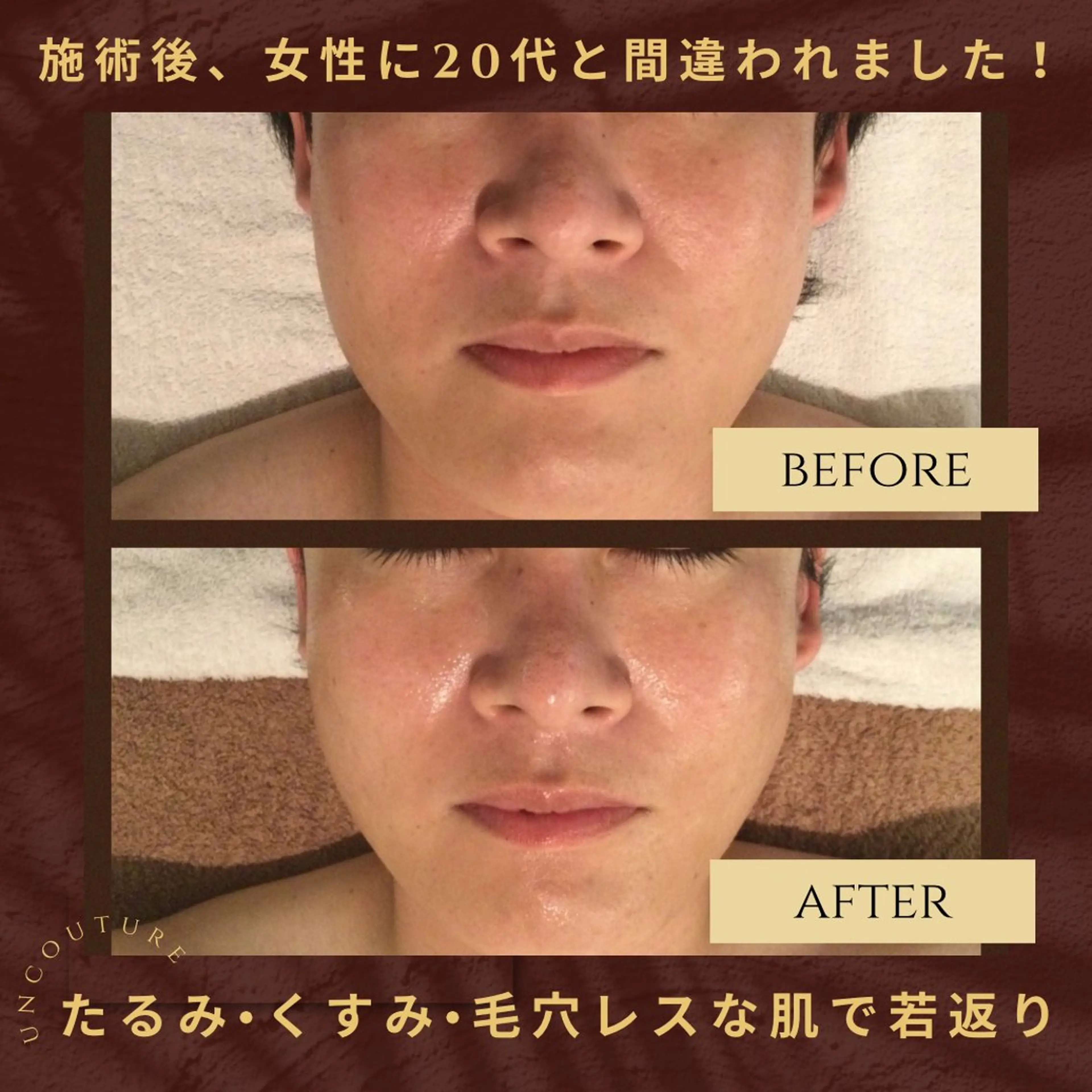 メンズ UnCouture 〜アンクチュール〜のエステ・リラクイメージ