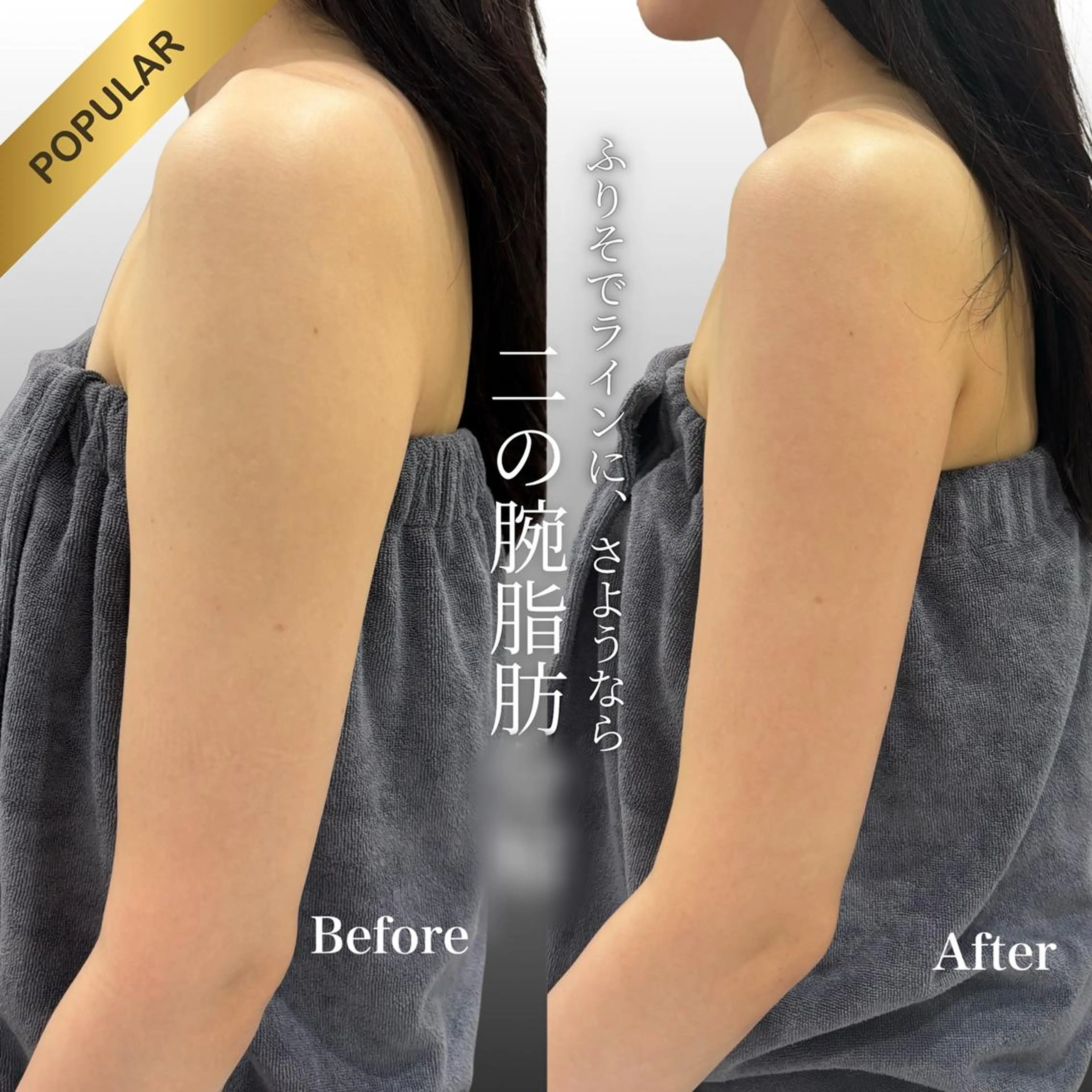 【人気No.1】5cc | 顎下・二の腕・部分集中サイズダウン🔥の写真