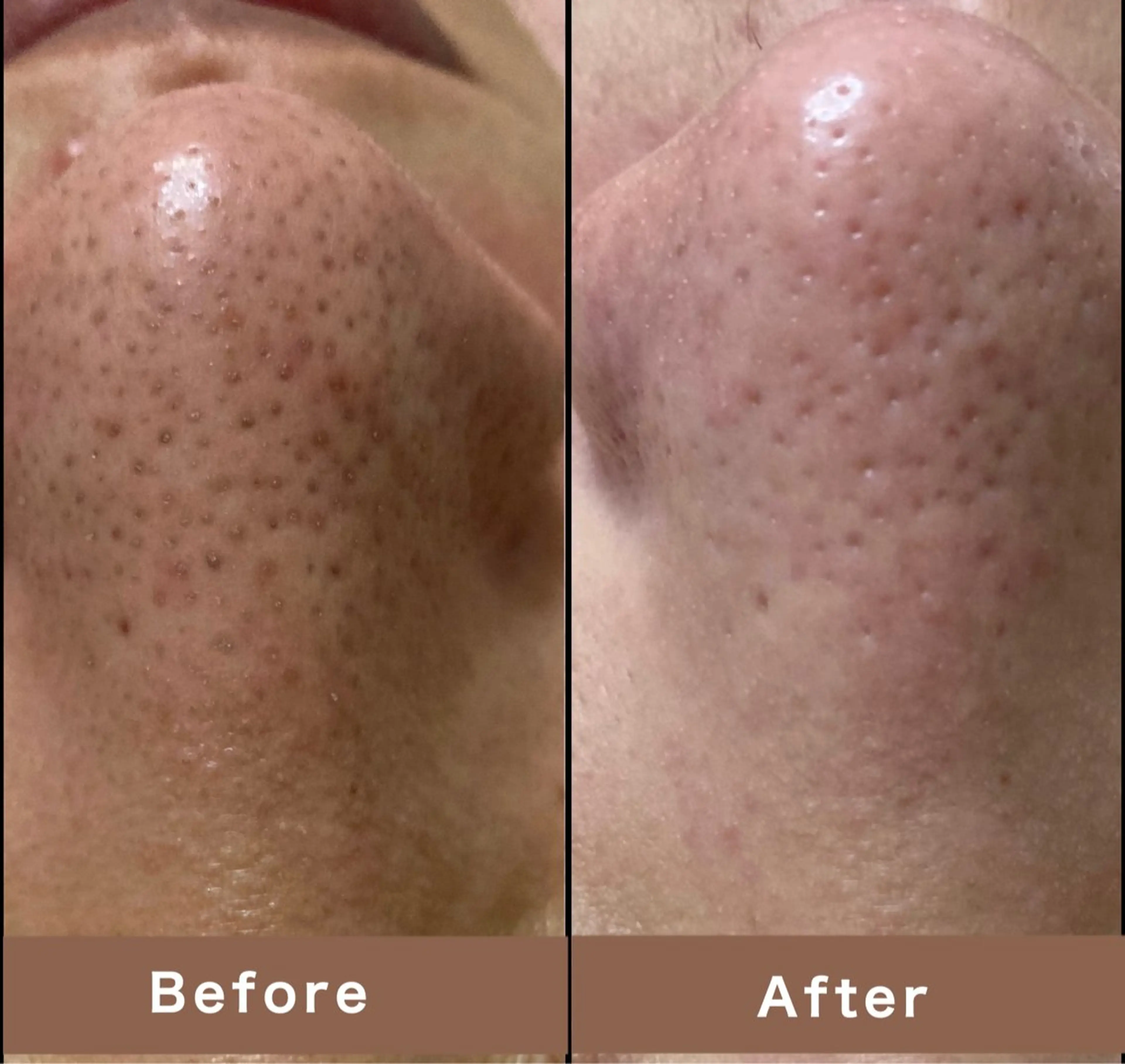 エステ Mano Amikaのエステ・リラクイメージ