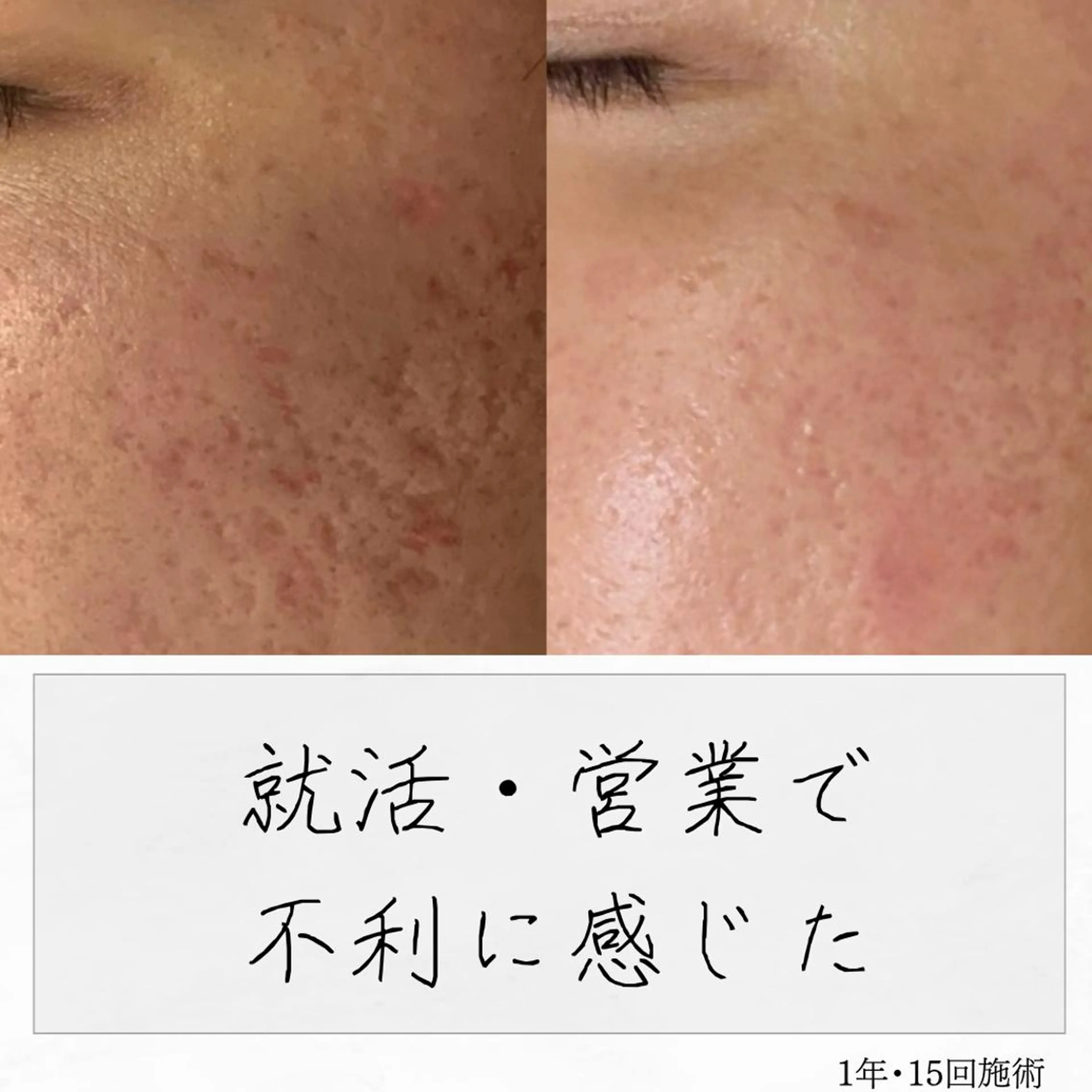 ニキビ経験者が施術 する専門サロン🌻のエステ・リラクイメージ