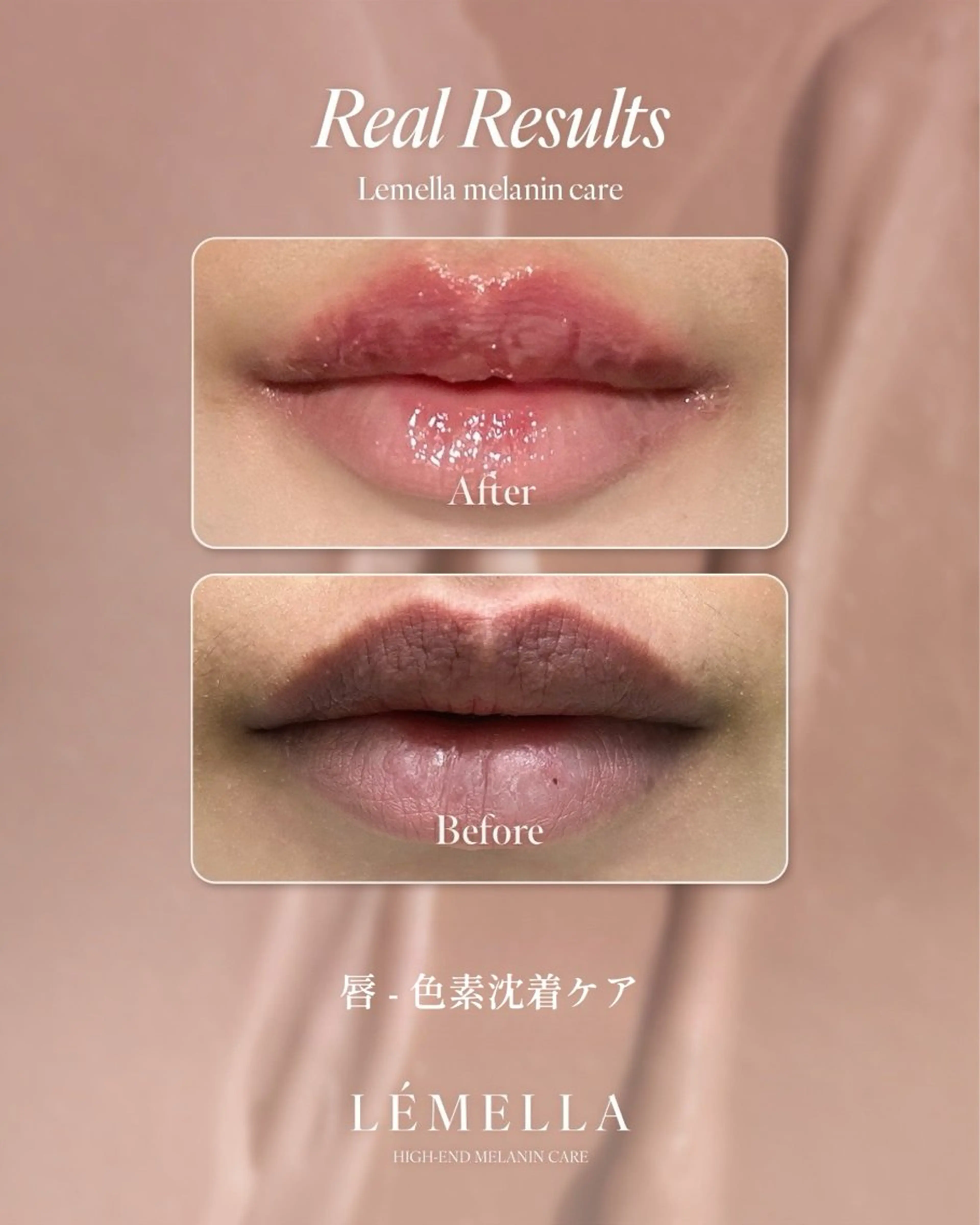 エステ リラク Lovers MOMOのマツエク・マツパデザイン