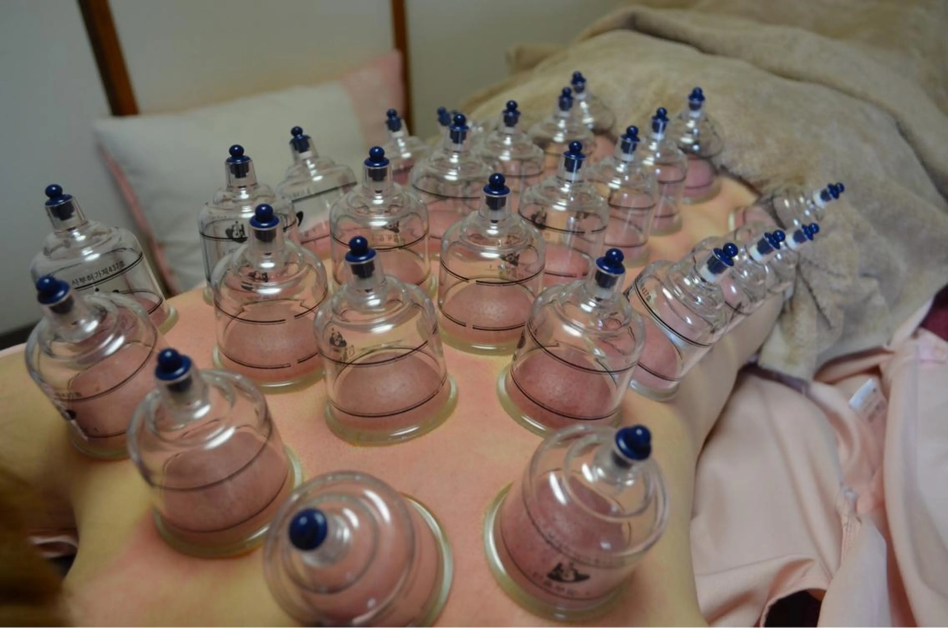 その他 美容鍼灸女性専用 りんご鍼灸治療院のその他イメージ