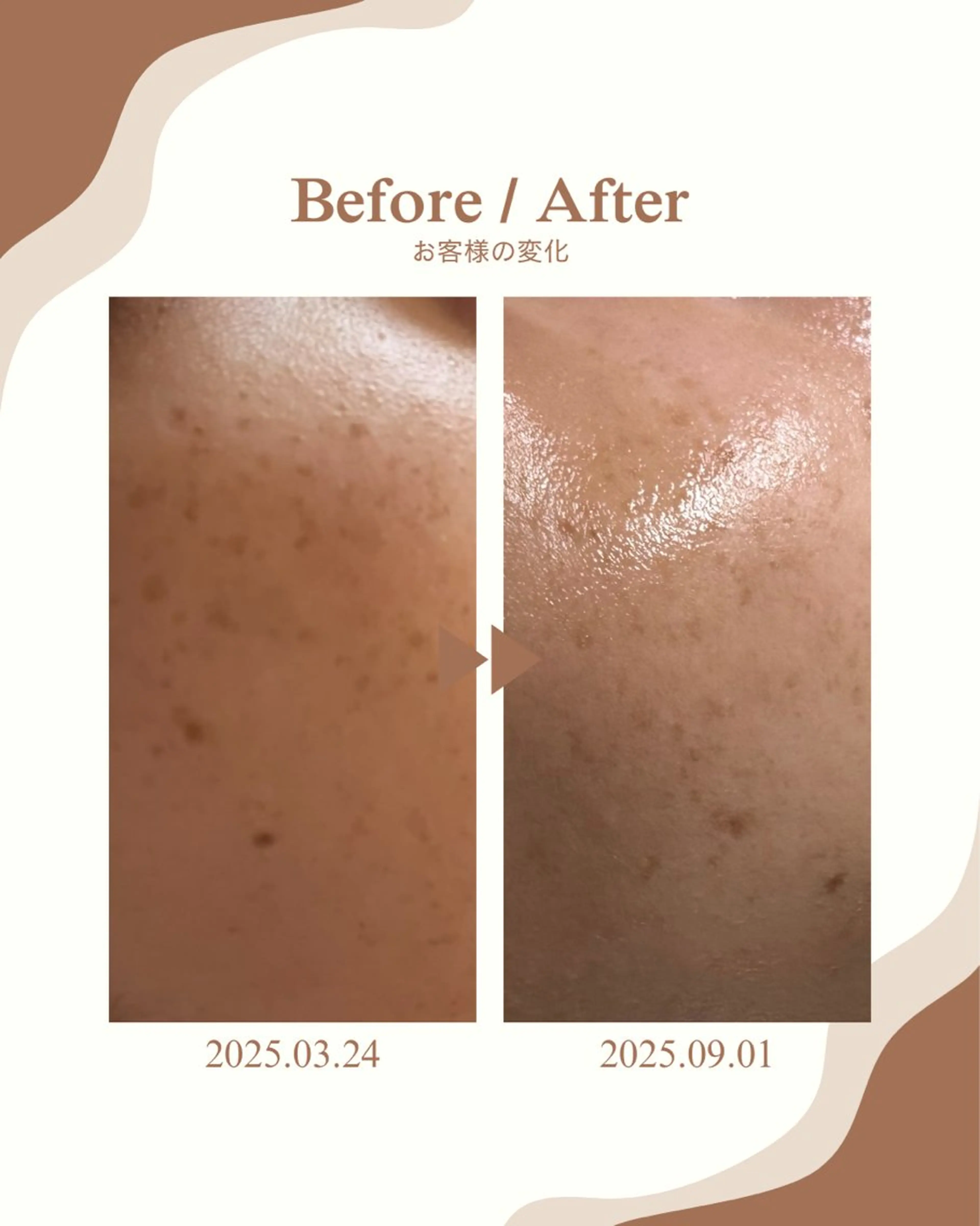 エステ skinLabo所属・saya Mのエステ・リラクイメージ