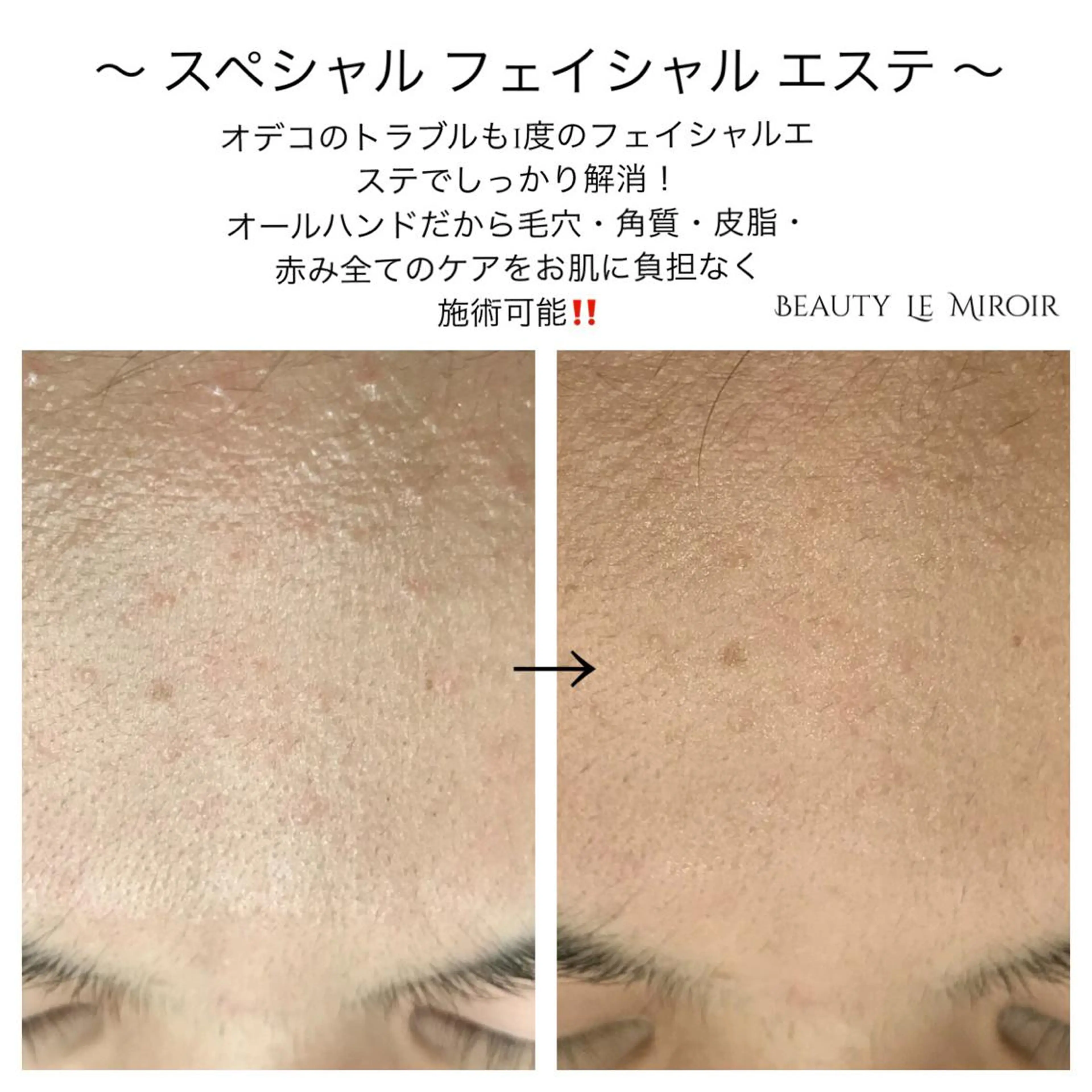 ビューティー ミロワールのエステ・リラクイメージ