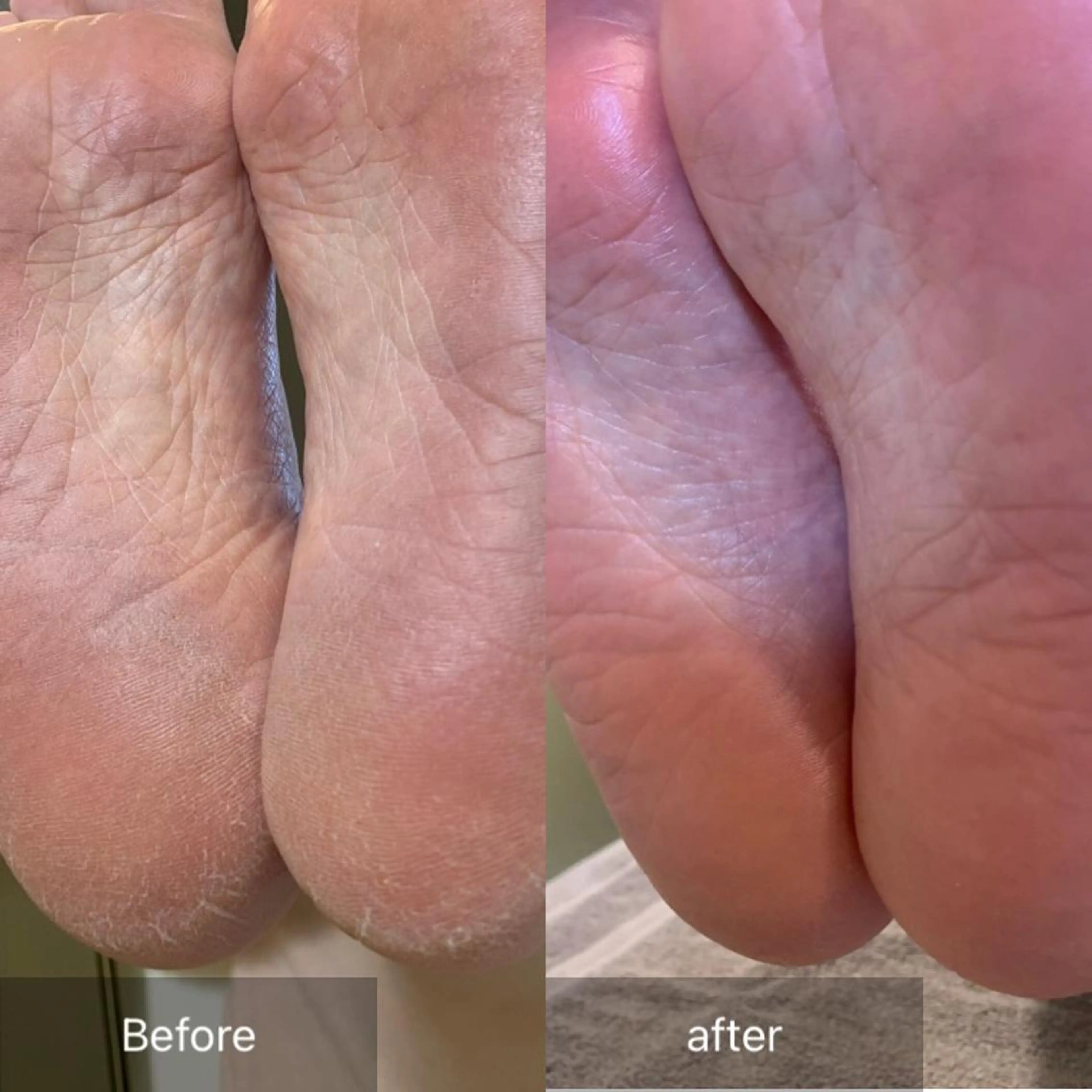 その他(ネイル) 木村 千晴のネイルデザイン