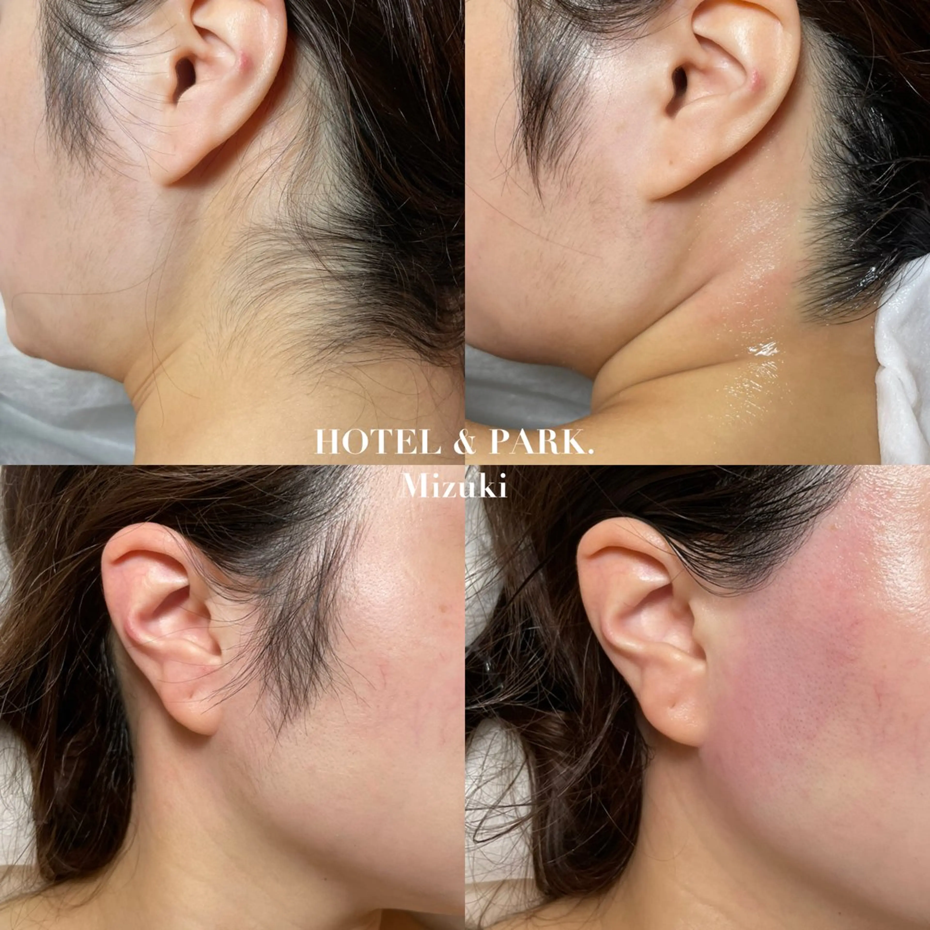 脱毛 HOTEL&PARK . ワックス脱毛のエステ・リラクイメージ