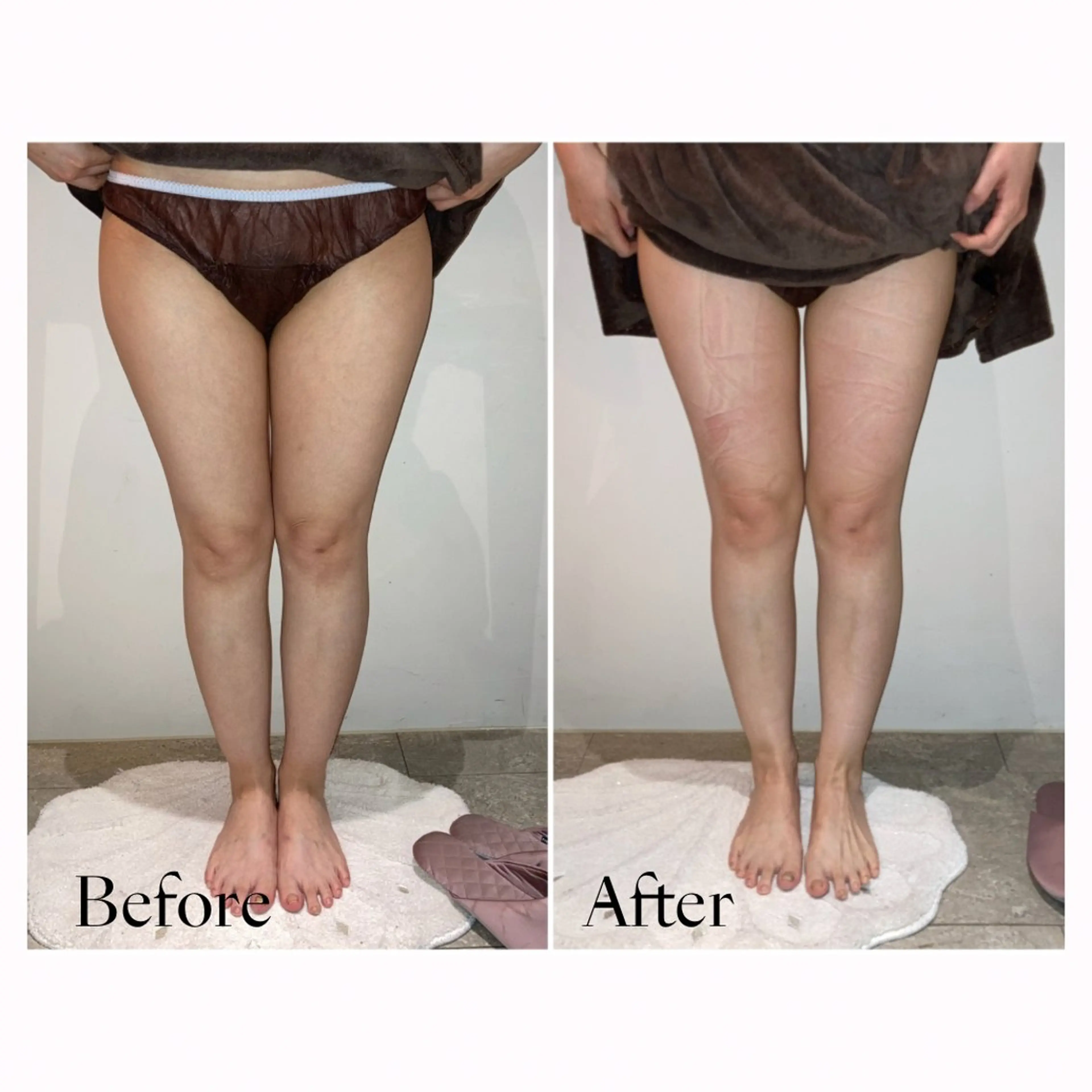 エステ 津村 夏実のエステ・リラクイメージ