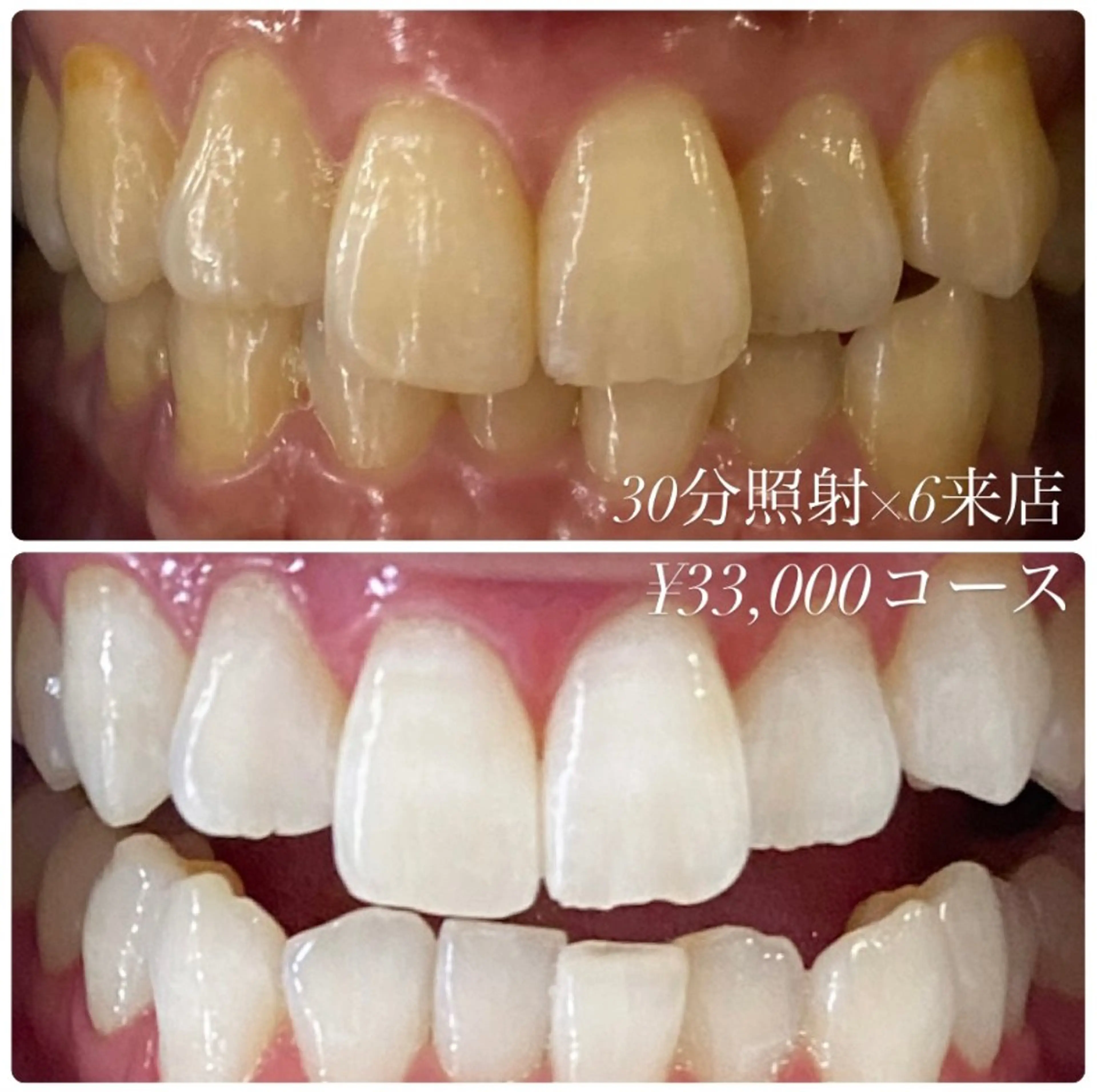 その他 ホワイトニング ルーム　川崎店のその他イメージ