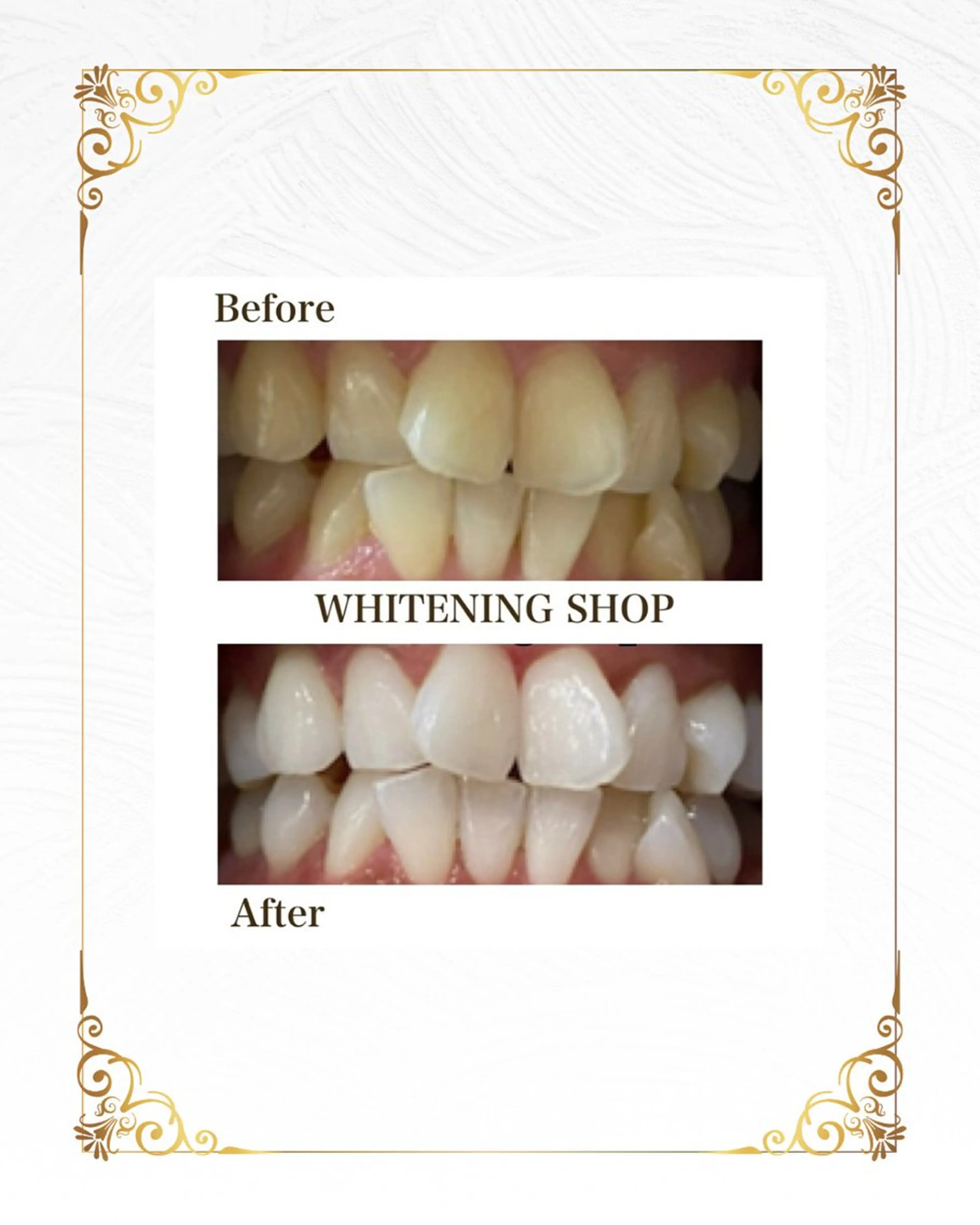 ホワイトニング ショップ葵区静岡駅店のその他イメージ