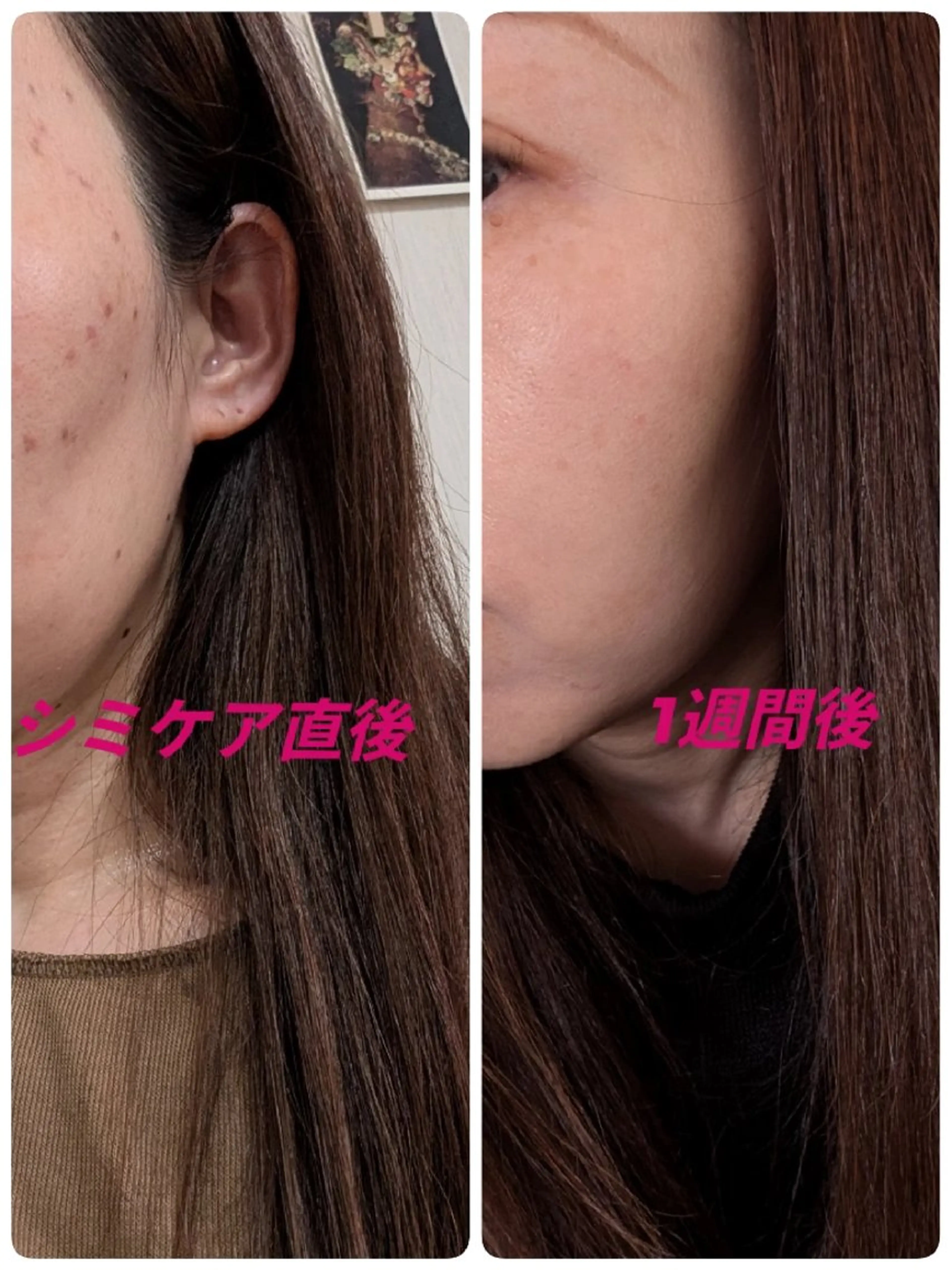 SPOT.com  シミケア専門店のエステ・リラクイメージ