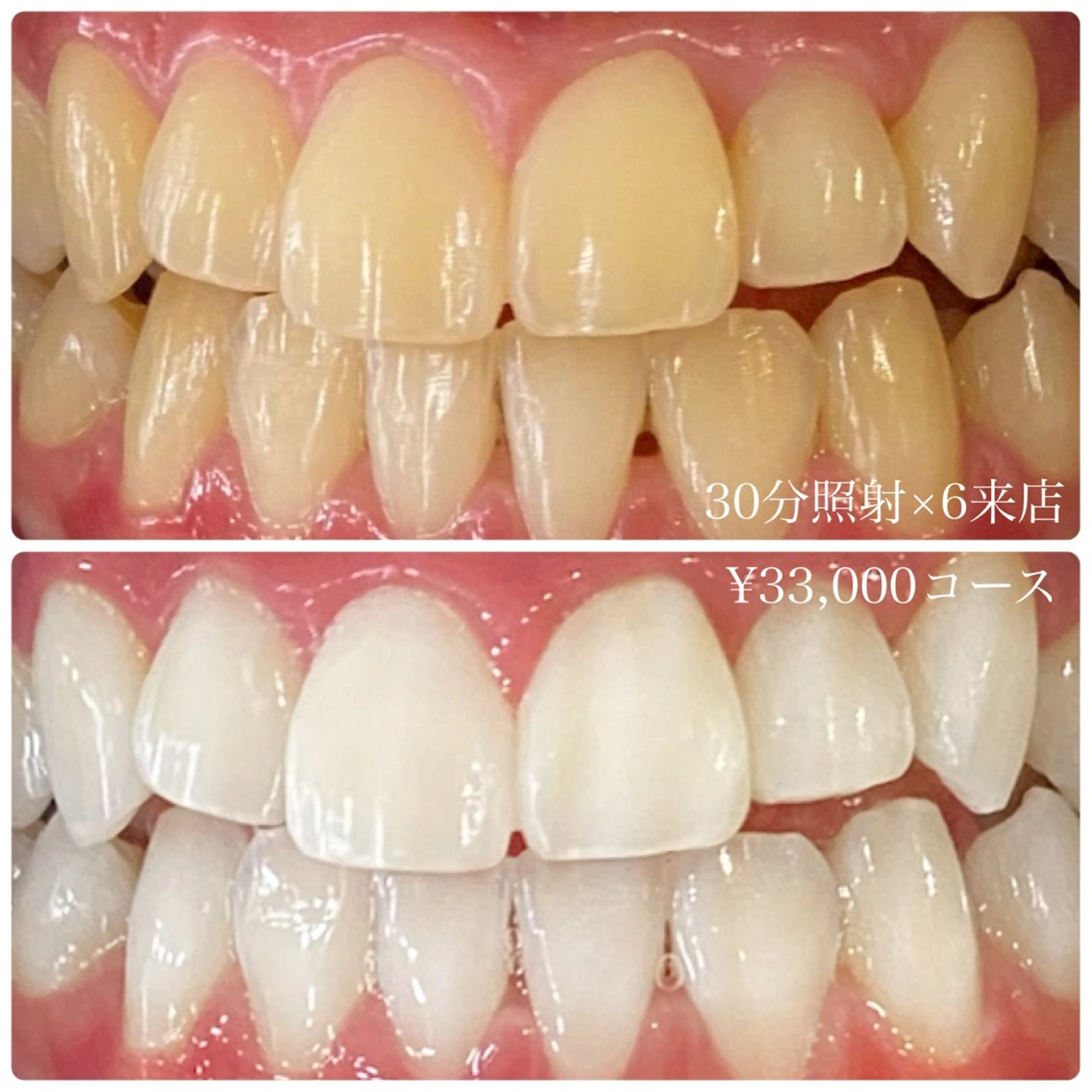 メンズ その他 ホワイトニング ルーム　川崎店のその他イメージ