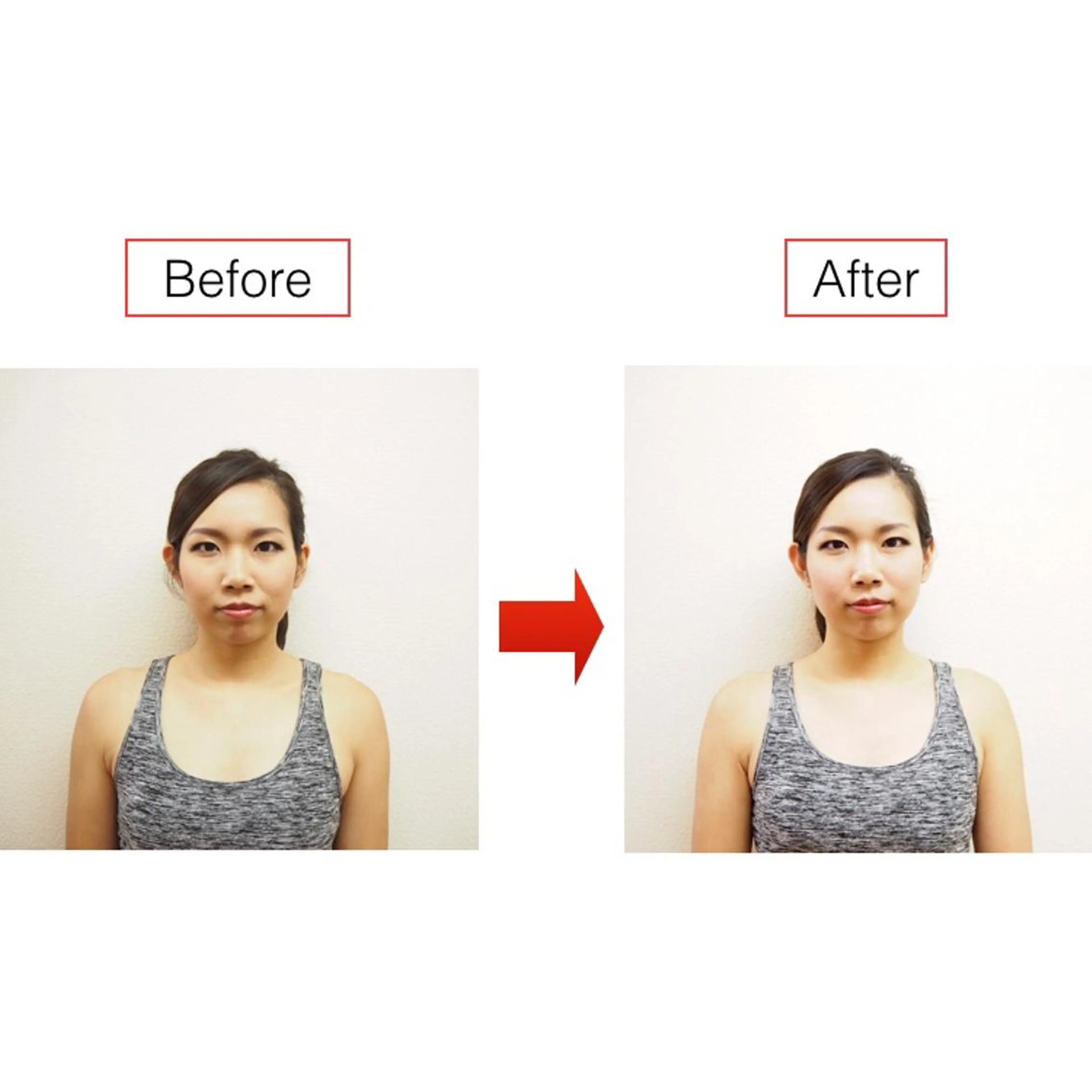 小顔ハーブピーリング 美容鍼/毛穴洗浄のエステ・リラクイメージ