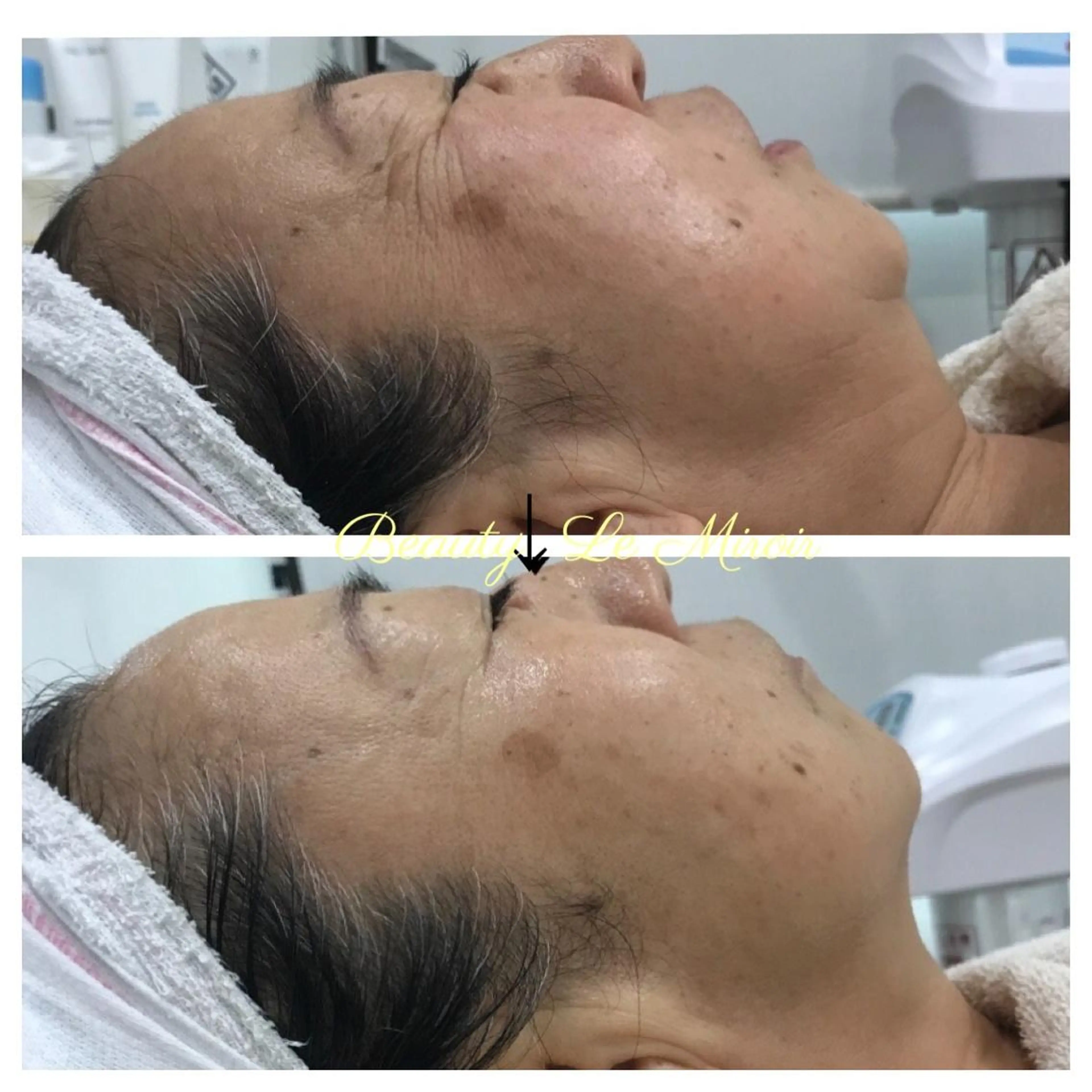 ビューティー ミロワールのエステ・リラクイメージ