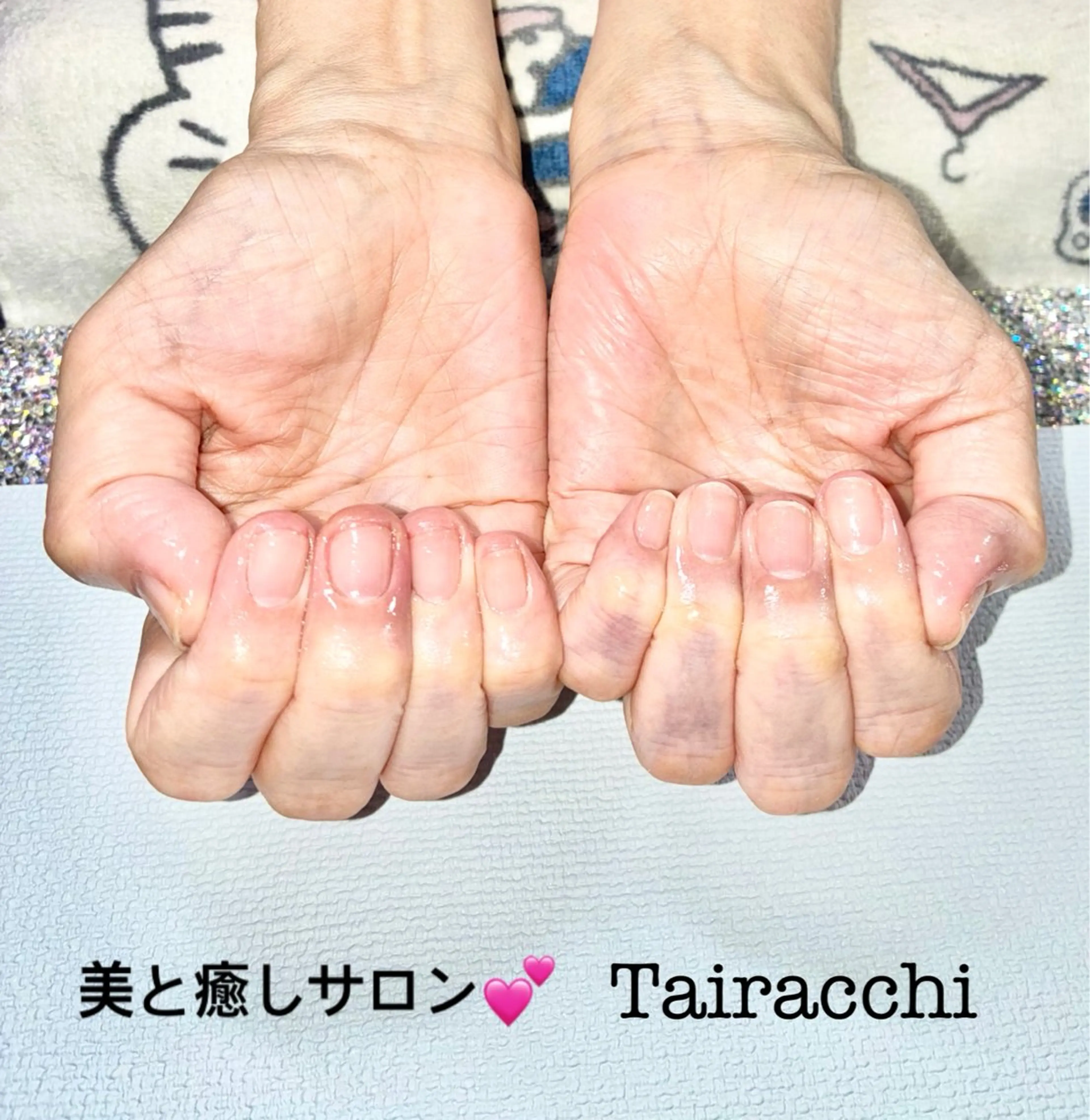 ネイル ハンドケア Tairacchi ﾀｲﾗｯﾁのエステ・リラクイメージ