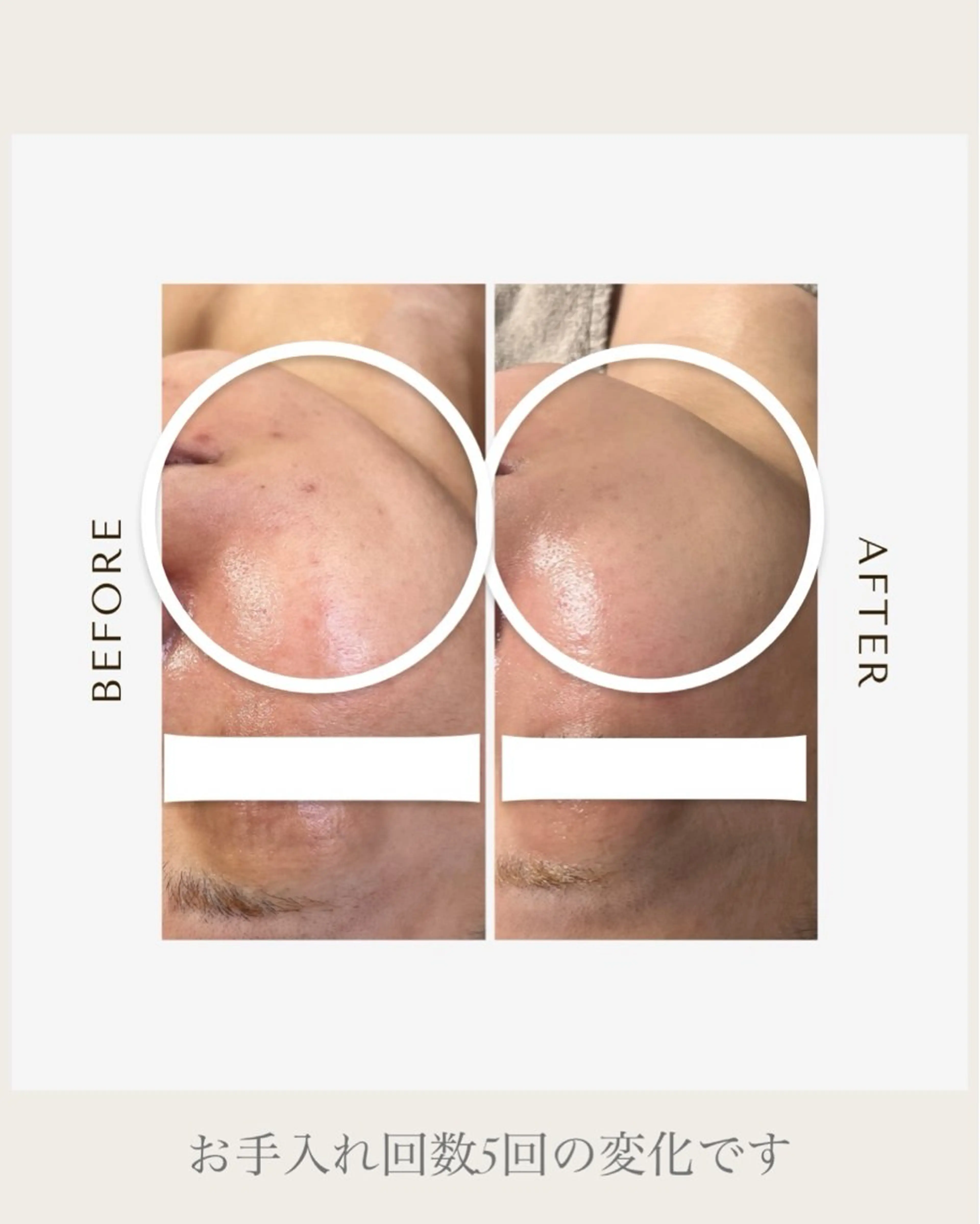 エステ 1st｜フェイシャル エステ専門店のエステ・リラクイメージ